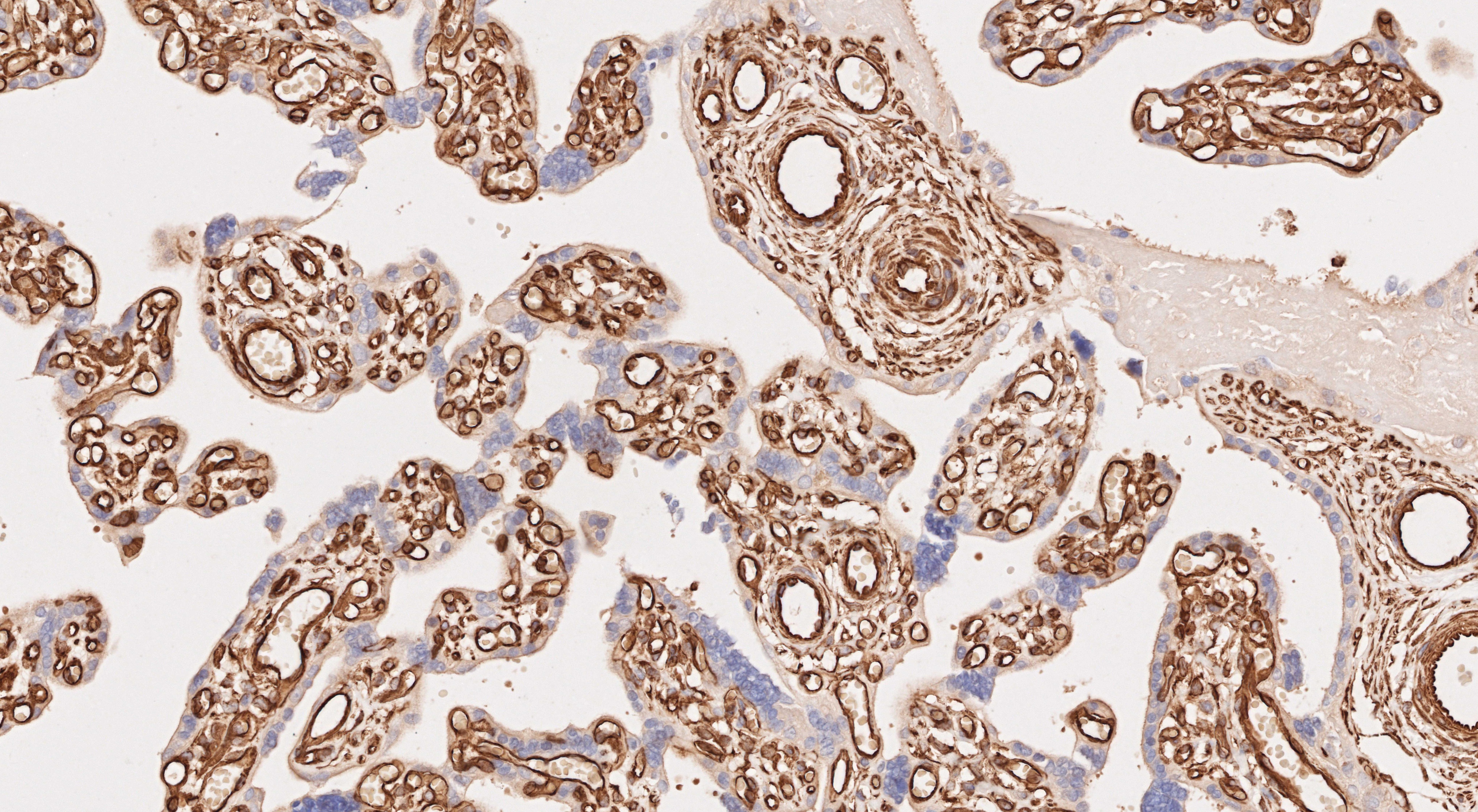 Immunohistochemistry of 80232-1-RR (Vim rabbit recombinant antibody, 1:5000) in human placenta tissue. PR30018 (DAB) was used as substrate.
