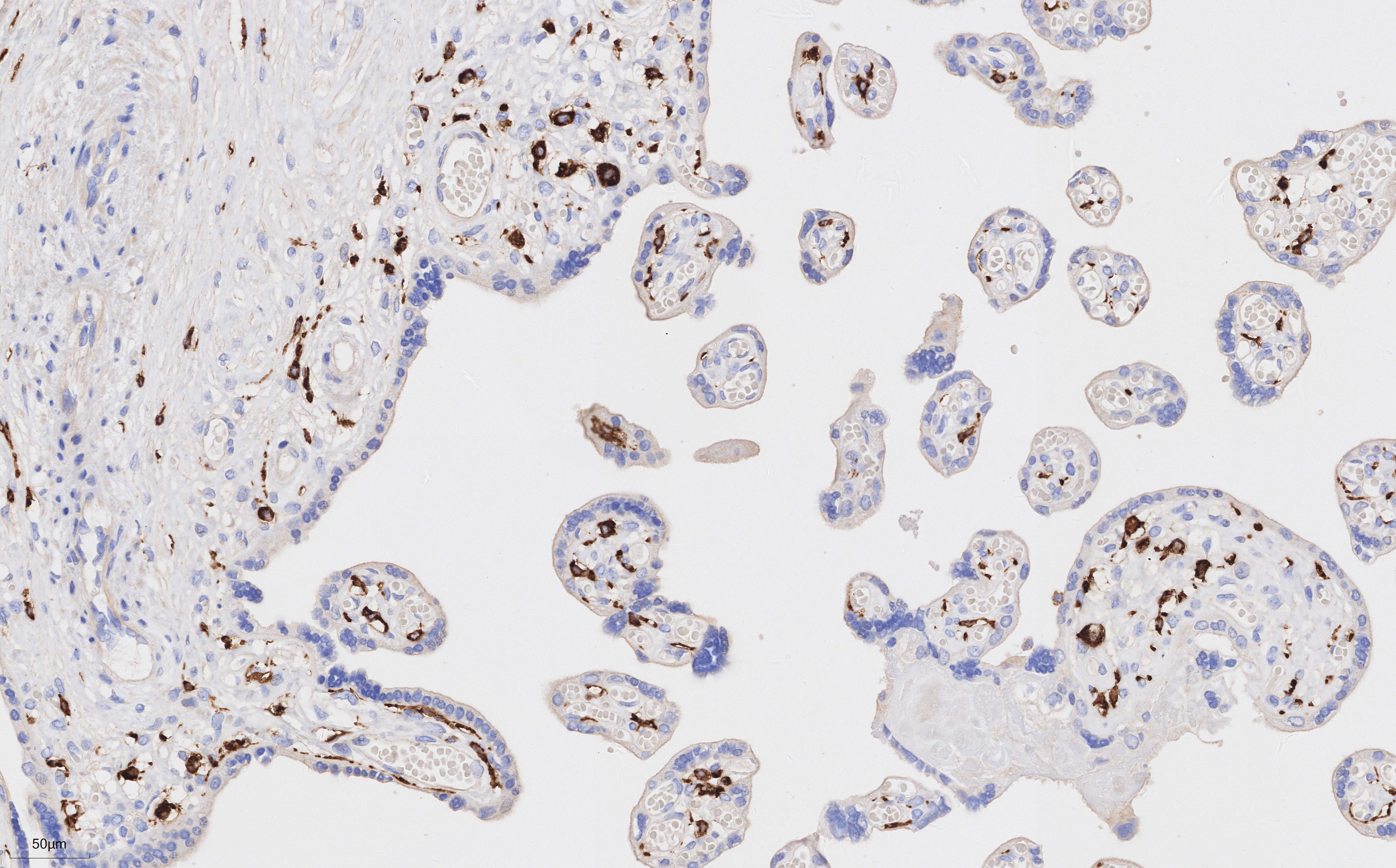 Immunohistochemistry of 68218-1-Ig (CD163 mouse monoclonal antibody, 1:5000) in human placenta tissue. PR30018 (DAB) was used as substrate.