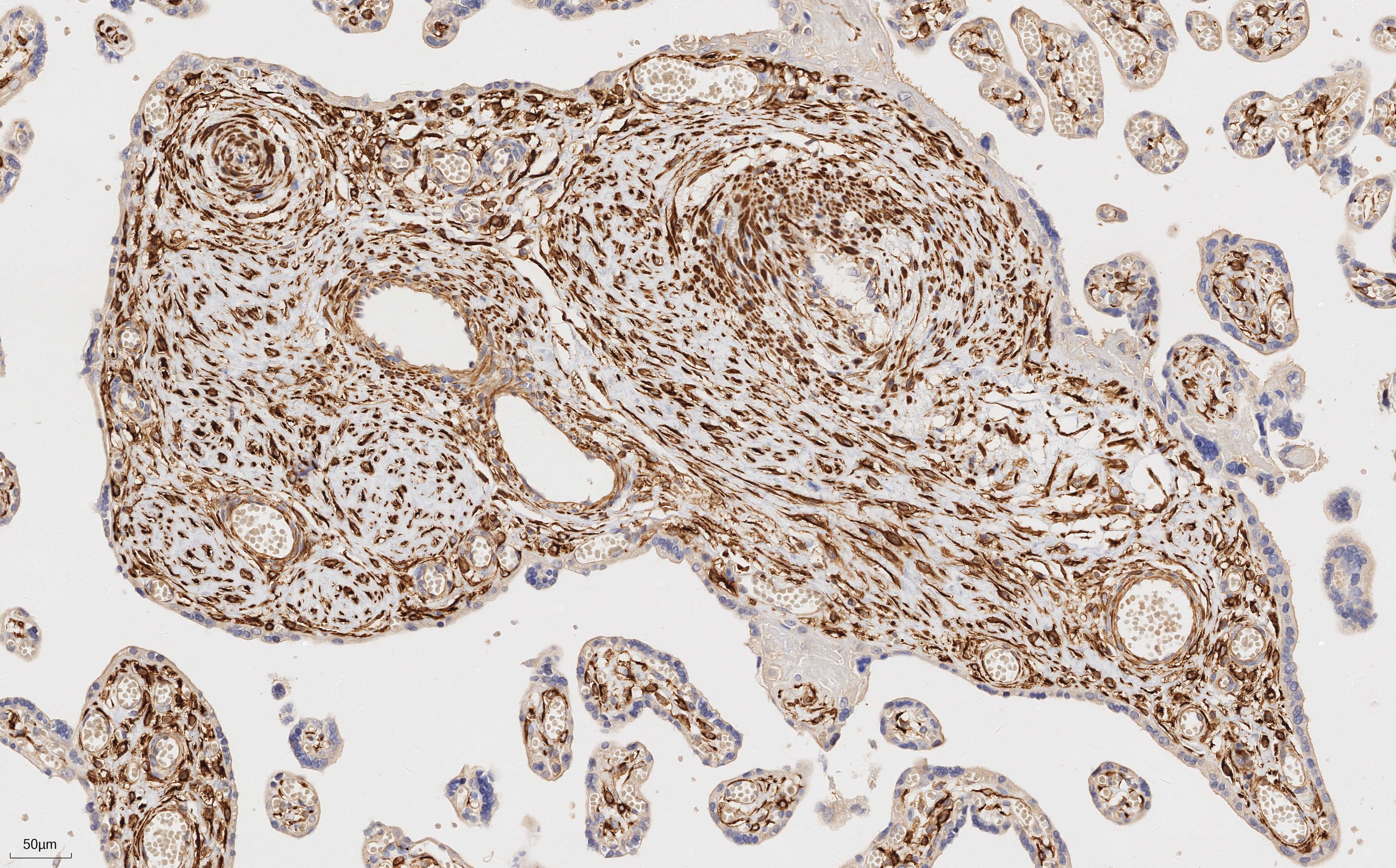 Immunohistochemistry of 67793-1-Ig (Desmin mouse monoclonal antibody, 1:2000) in human placenta tissue. PR30018 (DAB) was used as substrate.