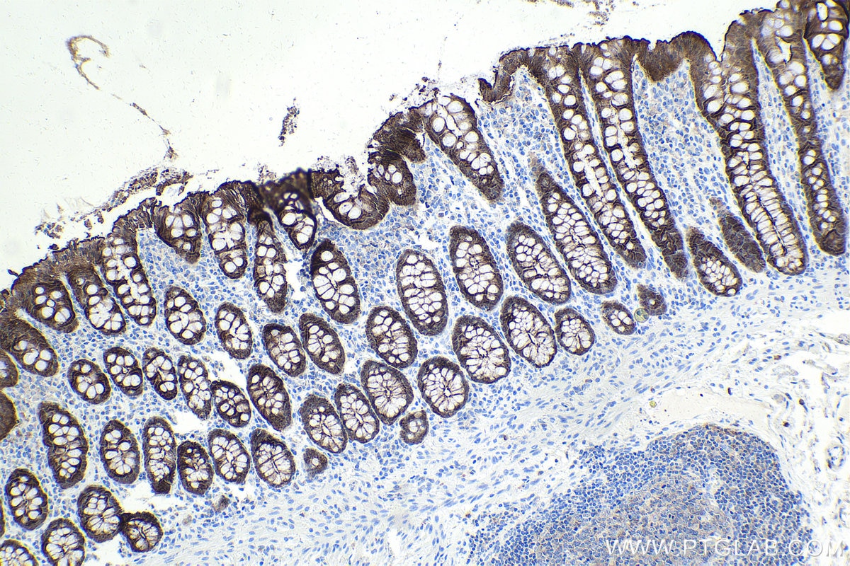 Immunohistochemical analysis of paraffin-embedded human colon tissue slide using 66096-1-Ig (Villin antibody) at dilution of 1:5000 (under 10x lens). Heat mediated antigen retrieval with Tris-EDTA buffer (pH 9.0). Multi-rAb Polymer HRP-Goat anti-Mouse Recombinant secondary antibody RGAM011 was used for detection.