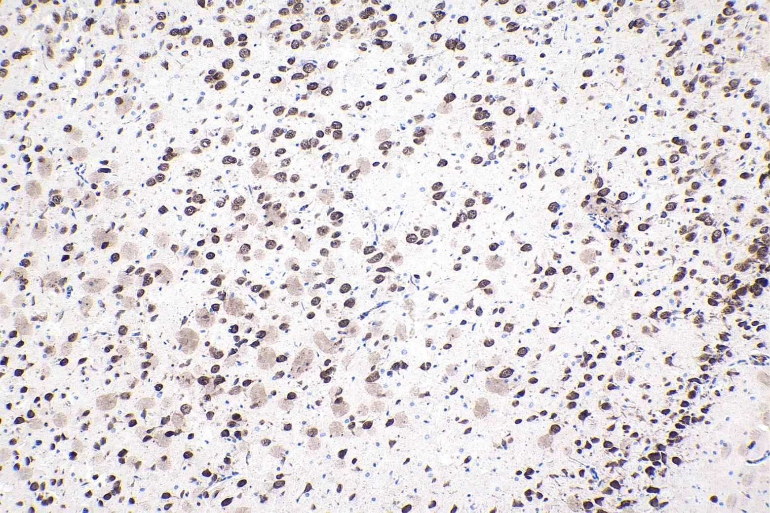 Immunohistochemical analysis of paraffin-embedded rat brain tissue slide using other vendor's NeuN mouse monoclonal antibody. Heat mediated antigen retrieval with Tris-EDTA buffer (pH 9.0). Multi-rAb Polymer HRP-Goat anti-mouse Recombinant secondary antibody RGAM011 was used for detection.