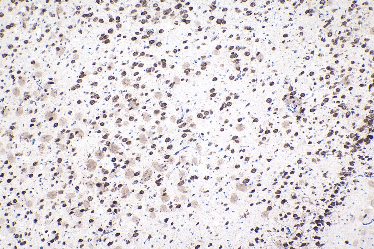 Immunohistochemical analysis of paraffin-embedded rat brain tissue slide using other vendor's NeuN mouse monoclonal antibody. Heat mediated antigen retrieval with Tris-EDTA buffer (pH 9.0). Multi-rAb™ Polymer HRP-Goat anti-mouse Recombinant secondary antibody RGAM011 was used for detection.