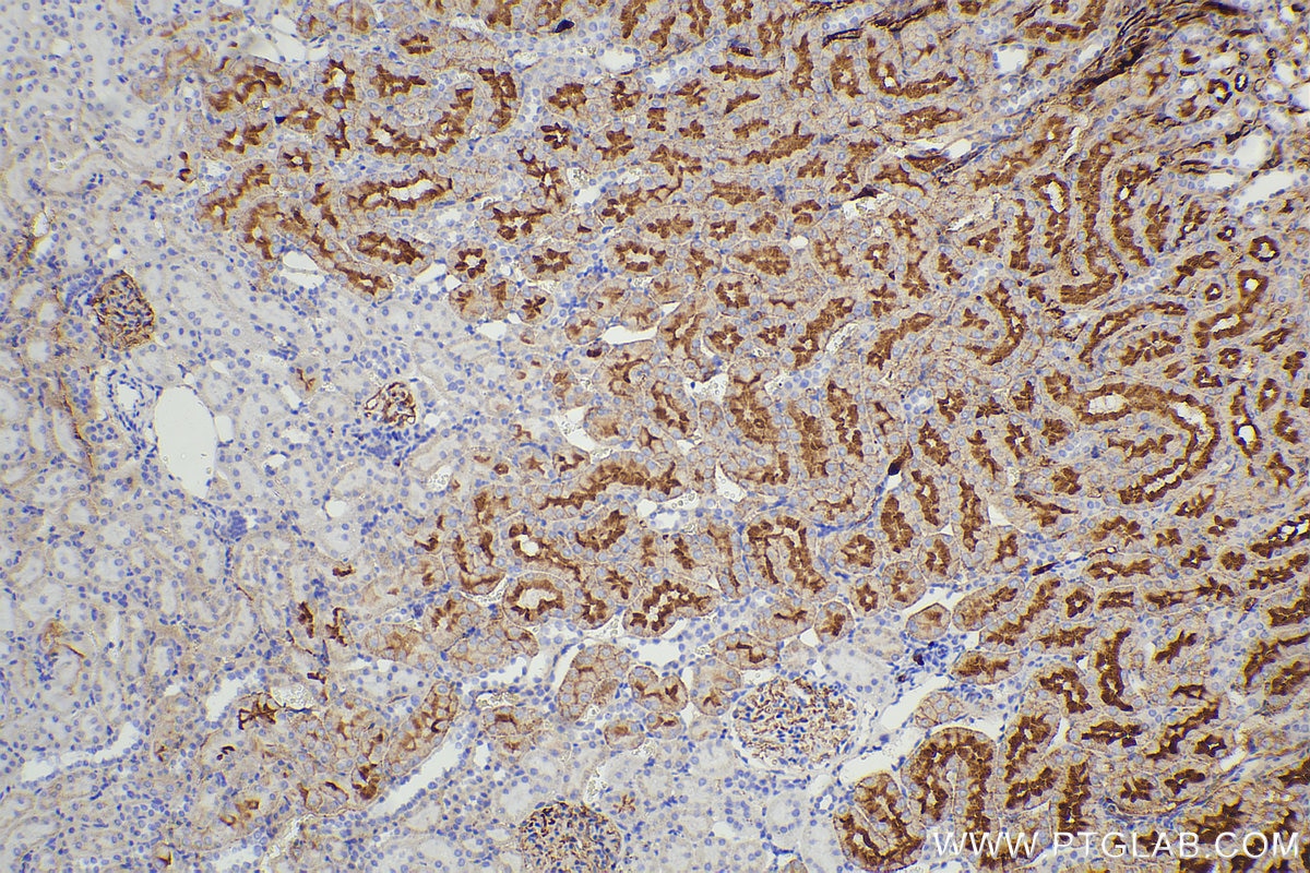 Immunohistochemical analysis of paraffin-embedded rat kidney tissue slide using 67479-1-Ig (SLC22A7 antibody) at dilution of 1:2000 (under 10x lens). Heat mediated antigen retrieval with Tris-EDTA buffer (pH 9.0). Multi-rAb™ Polymer HRP-Goat anti-Mouse Recombinant secondary antibody RGAM011 was used for detection. The staining was performed on Celnovte's CNT360-M1 autostainer.