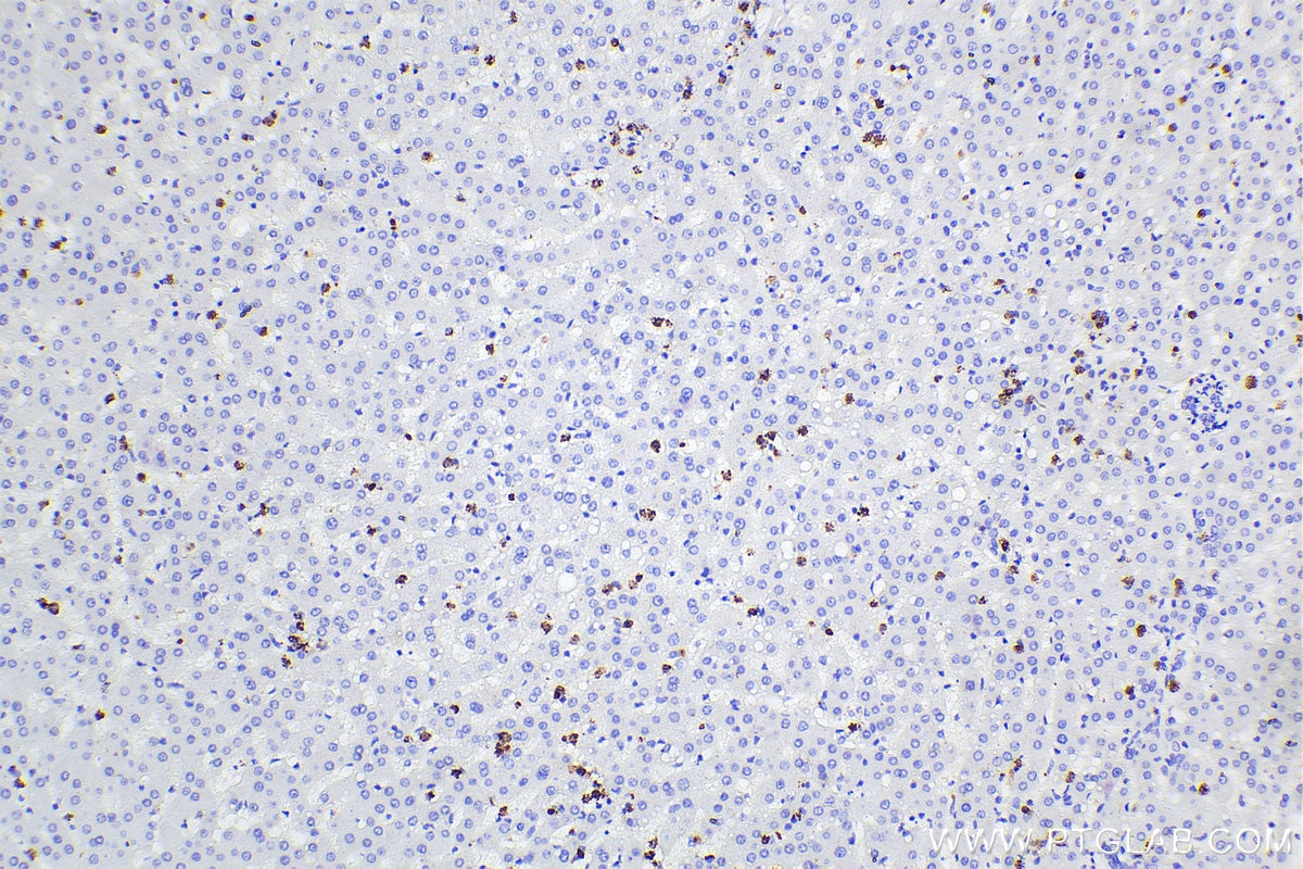 Immunohistochemical analysis of paraffin-embedded human liver tissue slide using 66177-1-Ig (MPO antibody) at dilution of 1:5000 (under 10x lens). Heat mediated antigen retrieval with Tris-EDTA buffer (pH 9.0). Multi-rAb Polymer HRP-Goat anti-Mouse Recombinant secondary antibody RGAM011 was used for detection. The staining was performed on Celnovte's CNT360-M1 autostainer.