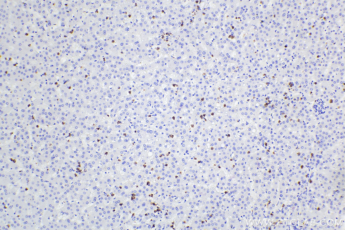 Immunohistochemical analysis of paraffin-embedded human liver tissue slide using 66177-1-Ig (MPO antibody) at dilution of 1:5000 (under 10x lens). Heat mediated antigen retrieval with Tris-EDTA buffer (pH 9.0). Multi-rAb™ Polymer HRP-Goat anti-Mouse Recombinant secondary antibody RGAM011 was used for detection. The staining was performed on Celnovte's CNT360-M1 autostainer.