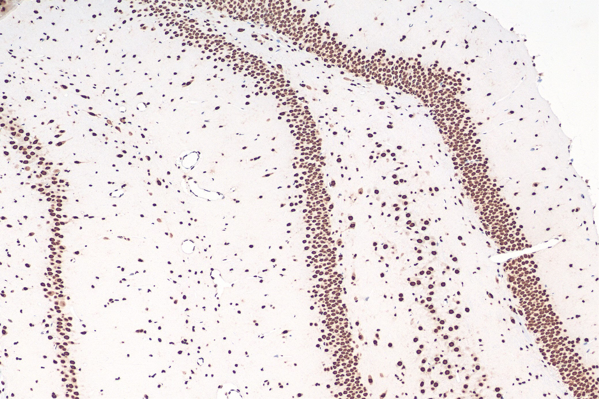 Immunohistochemical analysis of paraffin-embedded rat brain tissue slide using 80001-1-RR (TDP43 recombinant antibody) at dilution of 1:4000 (under 10x lens). Heat mediated antigen retrieval with Tris-EDTA buffer (pH 9.0). Multi-rAb™ Polymer HRP-Goat anti-Rabbit Recombinant secondary antibody RGAR011 was used for detection.