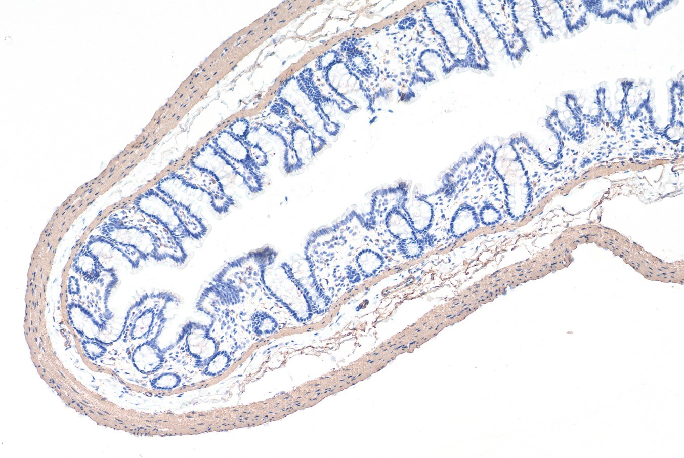 Immunohistochemical analysis of paraffin-embedded rat colon tissue slide using 80008-1-RR (smooth muscle actin recombinant antibody) at dilution of 1:10000 (under 10x lens). Heat mediated antigen retrieval with Tris-EDTA buffer (pH 9.0). Multi-rAb™ Polymer HRP-Goat anti-rabbit Recombinant secondary antibody RGAR011 was used for detection