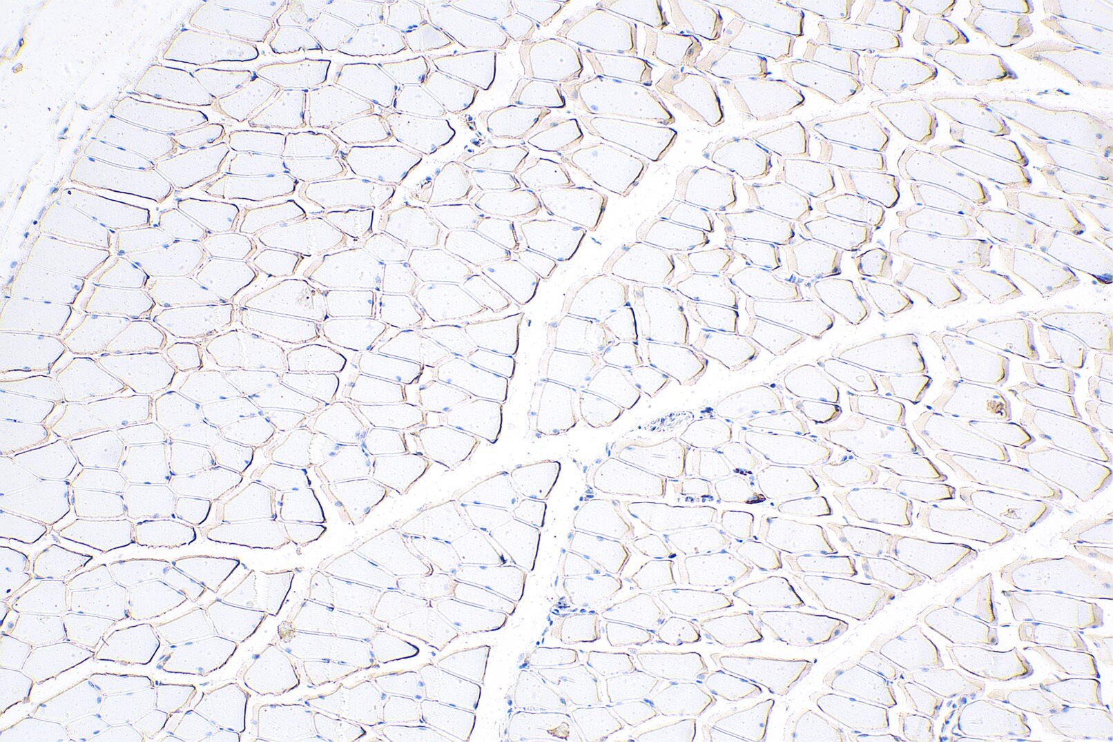 Immunohistochemical analysis of paraffin-embedded mouse skeletal muscle tissue slide using 12715-1-AP (Dystrophin polyclonal antibody) at dilution of 1:10000 (under 10x lens). Heat mediated antigen retrieval with Tris-EDTA buffer (pH 9.0). Multi-rAb™ Polymer HRP-Goat anti-rabbit Recombinant secondary antibody RGAR011 was used for detection.