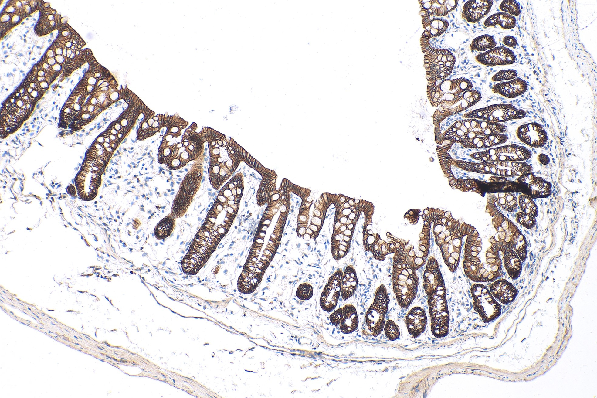 Immunohistochemical analysis of paraffin-embedded mouse colon tissue slide using 20874-1-AP (E-cadherin polyclonal antibody) at dilution of 1:5000 (under 10x lens). Heat mediated antigen retrieval with Tris-EDTA buffer (pH 9.0). Multi-rAb™ Polymer HRP-Goat anti-rabbit Recombinant secondary antibody RGAR011 was used for detection.