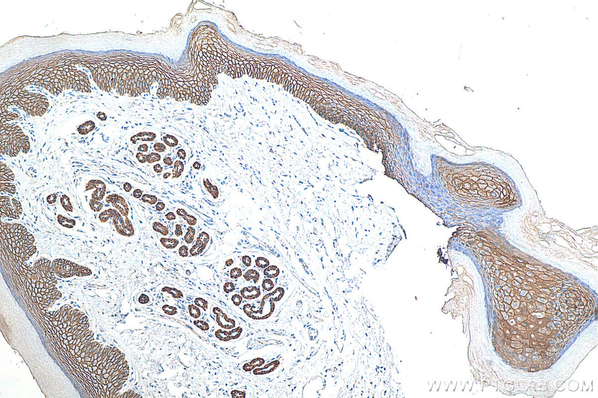 Immunohistochemical analysis of paraffin-embedded mouse skin tissue slide using 20874-1-AP (E-cadherin polyclonal antibody) at dilution of 1:5000 (under 10x lens). Heat mediated antigen retrieval with Tris-EDTA buffer (pH 9.0). Multi-rAb™ Polymer HRP-Goat anti-rabbit Recombinant secondary antibody RGAR011 was used for detection.