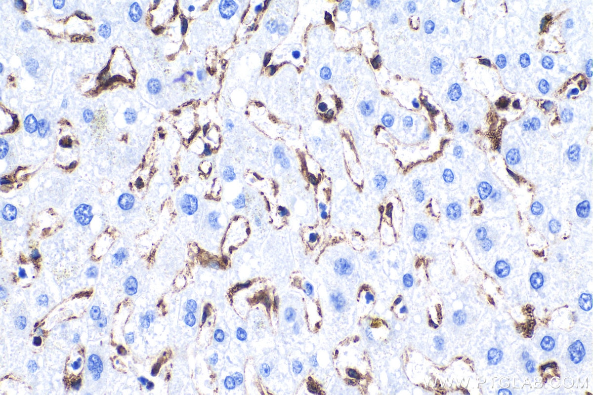 Immunohistochemical analysis of paraffin-embedded human liver tissue slide using 80165-1-RR (TMEM173/STING antibody) at dilution of 1:2000. Heat mediated antigen retrieval with Tris-EDTA buffer (pH 9.0). Multi-rAb™ Polymer HRP-Goat anti-rabbit Recombinant secondary antibody RGAR011 was used for detection.