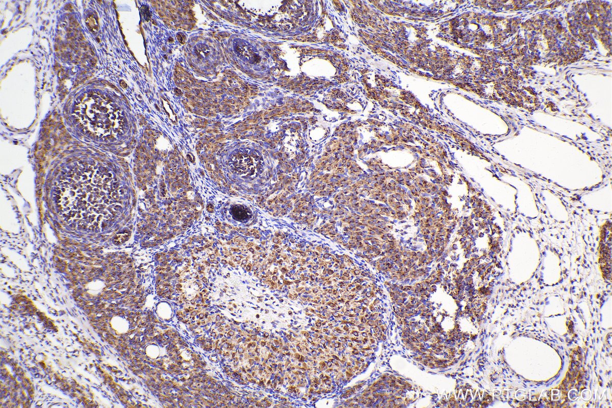 Immunohistochemical analysis of paraffin-embedded rat ovary tissue slide using 12255-1-AP (RCAS1 antibody) at dilution of 1:1000 (under 10x lens). Heat mediated antigen retrieval with Tris-EDTA buffer (pH 9.0). Multi-rAb™ Polymer HRP-Goat anti-rabbit Recombinant secondary antibody RGAR011 was used for detection. The staining was performed on Celnovte's CNT360-M1 autostainer.