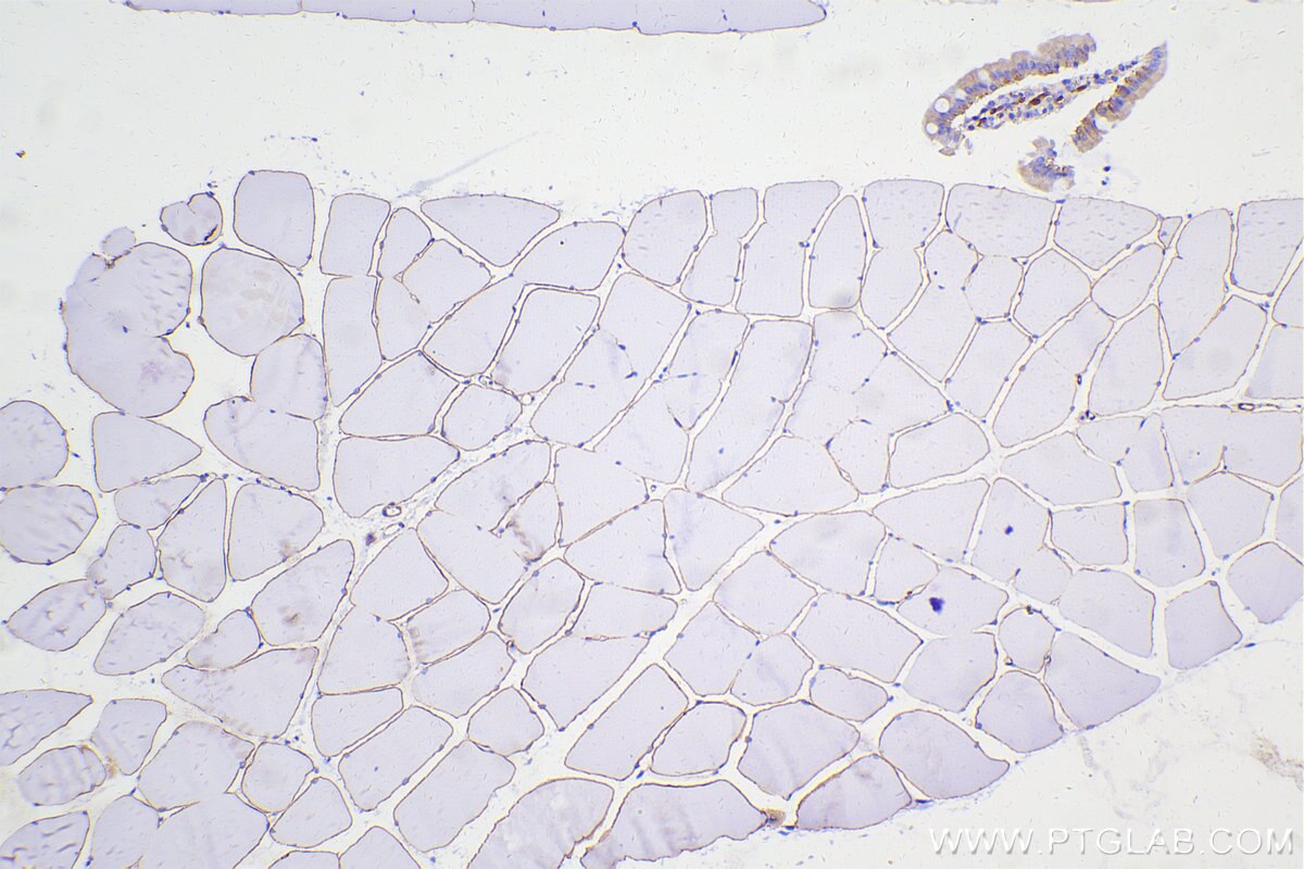 Immunohistochemical analysis of paraffin-embedded rat skeletal muscle tissue slide using 12715-1-AP (Dystrophin antibody) at dilution of 1:10000 (under 10x lens). Heat mediated antigen retrieval with Tris-EDTA buffer (pH 9.0). Multi-rAb™ Polymer HRP-Goat anti-rabbit Recombinant secondary antibody RGAR011 was used for detection. The staining was performed on Celnovte's CNT360-M1 autostainer. Multi-rAb Polymer HRP-Goat anti-rabbit Recombinant secondary antibody RGAR011 was used for detection. The staining was performed on Celnovte's CNT360-M1 autostainer.