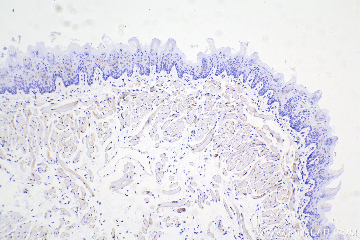 Immunohistochemical analysis of paraffin-embedded mouse tongue tissue slide using 12715-1-AP (Dystrophin antibody) at dilution of 1:10000 (under 10x lens). Heat mediated antigen retrieval with Tris-EDTA buffer (pH 9.0). Multi-rAb™ Polymer HRP-Goat anti-rabbit Recombinant secondary antibody RGAR011 was used for detection. The staining was performed on Celnovte's CNT360-M1 autostainer.