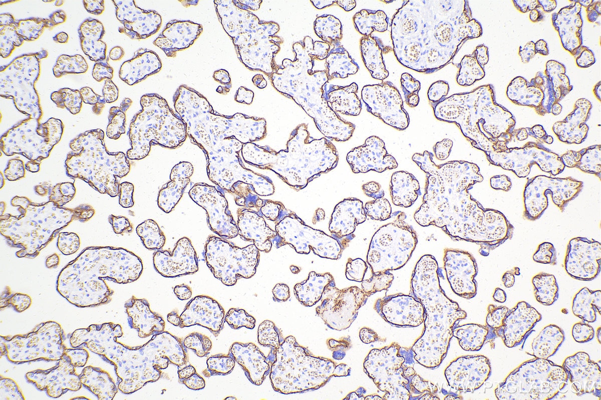 Immunohistochemical analysis of paraffin-embedded human placenta tissue slide using 20874-1-AP (E-cadherin antibody) at dilution of 1:5000 (under 10x lens). Heat mediated antigen retrieval with Tris-EDTA buffer (pH 9.0). Multi-rAb™ Polymer HRP-Goat anti-rabbit Recombinant secondary antibody RGAR011 was used for detection. The staining was performed on Celnovte's CNT360-M1 autostainer.