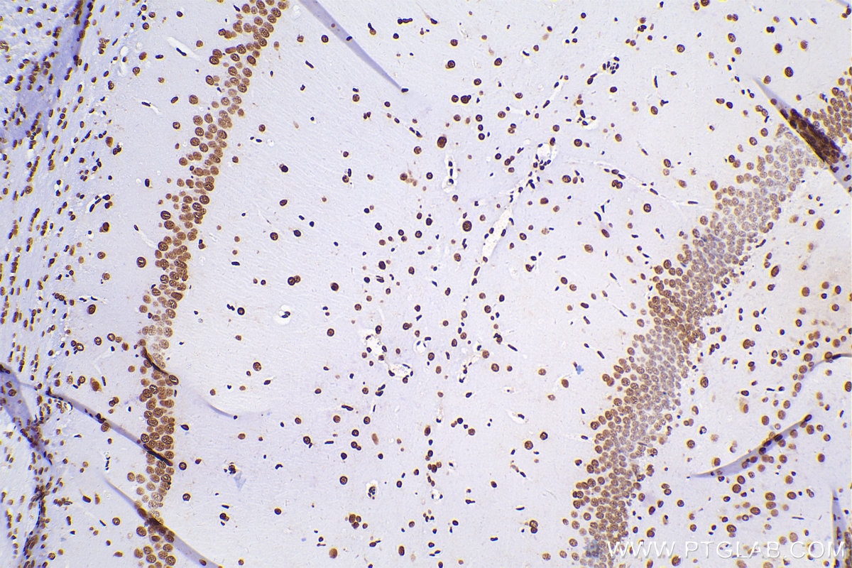 Immunohistochemical analysis of paraffin-embedded rat brain tissue slide using 80001-1-RR (TDP-43 antibody) at dilution of 1:4000 (under 10x lens). Heat mediated antigen retrieval with Tris-EDTA buffer (pH 9.0). Multi-rAb™ Polymer HRP-Goat anti-rabbit Recombinant secondary antibody RGAR011 was used for detection. The staining was performed on Celnovte's CNT360-M1 autostainer.