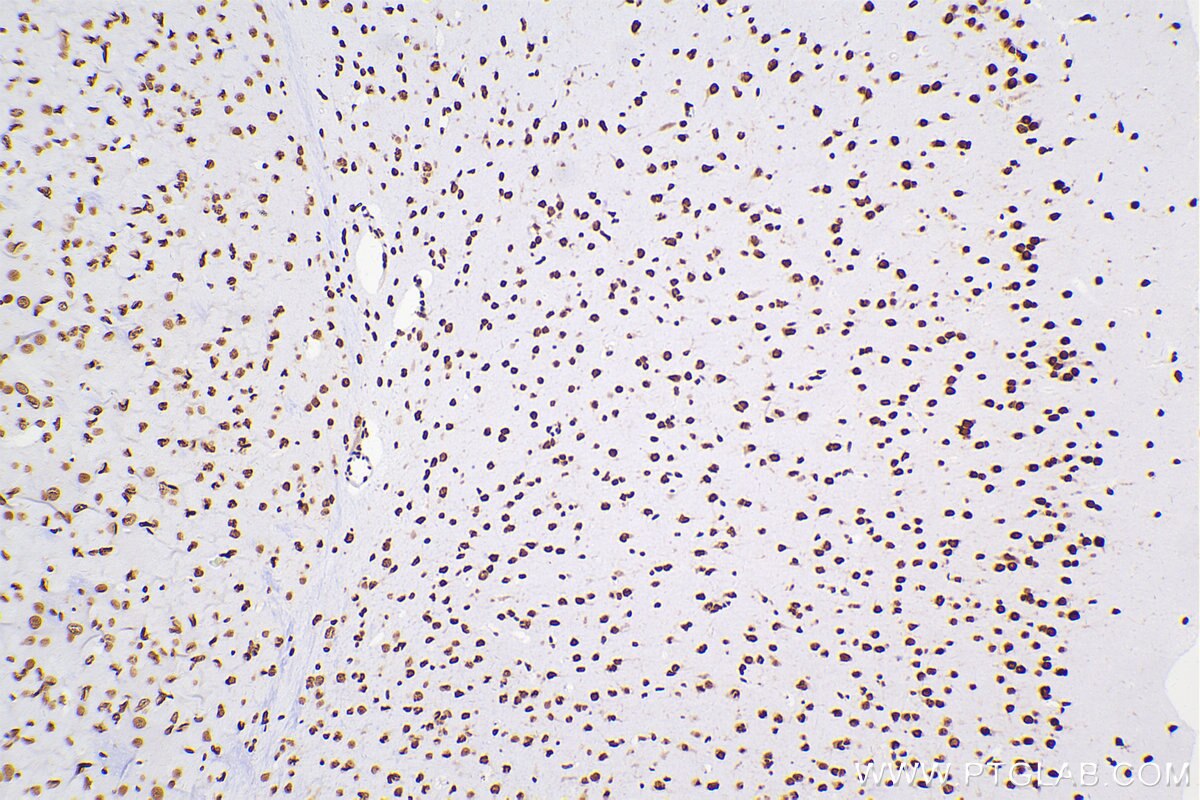 Immunohistochemical analysis of paraffin-embedded mouse brain tissue slide using 80001-1-RR (TDP-43 antibody) at dilution of 1:4000 (under 10x lens). Heat mediated antigen retrieval with Tris-EDTA buffer (pH 9.0). Multi-rAb™ Polymer HRP-Goat anti-rabbit Recombinant secondary antibody RGAR011 was used for detection. The staining was performed on Celnovte's CNT360-M1 autostainer.