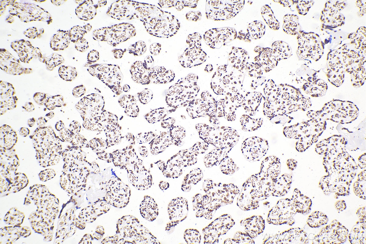 Immunohistochemical analysis of paraffin-embedded human placenta tissue slide using 80001-1-RR (TDP-43 antibody) at dilution of 1:4000 (under 10x lens). Heat mediated antigen retrieval with Tris-EDTA buffer (pH 9.0). Multi-rAb™ Polymer HRP-Goat anti-rabbit Recombinant secondary antibody RGAR011 was used for detection. The staining was performed on Celnovte's CNT360-M1 autostainer.