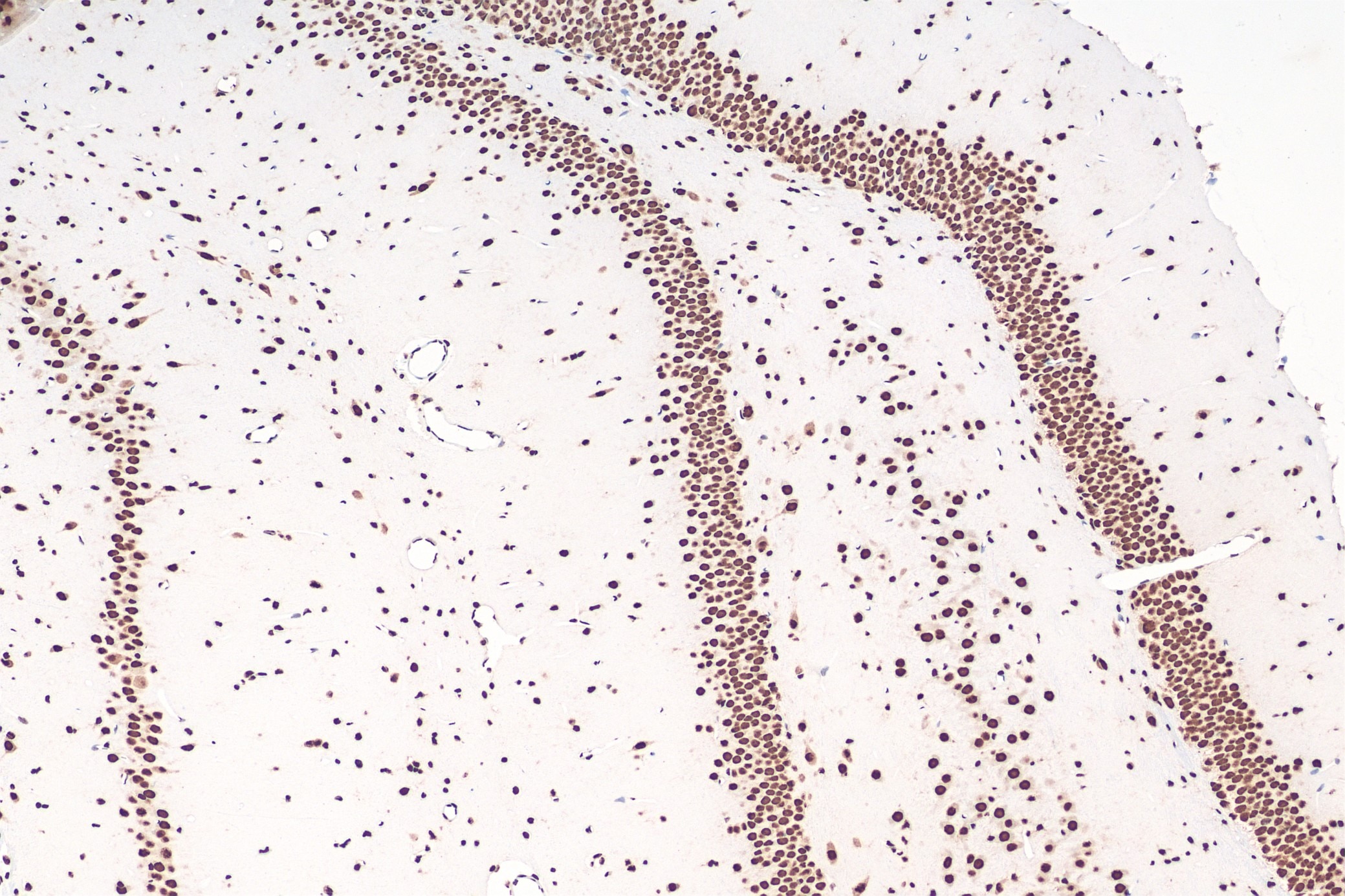 Immunohistochemical analysis of paraffin-embedded rat brain tissue slide using 80001-1-RR (TDP43 recombinant antibody) at dilution of 1:4000 (under 10x lens). Heat mediated antigen retrieval with Tris-EDTA buffer (pH 9.0). Multi-rAb Polymer HRP conjugated Goat anti-rabbit Recombinant secondary antibody RGAR011 was used for detection.