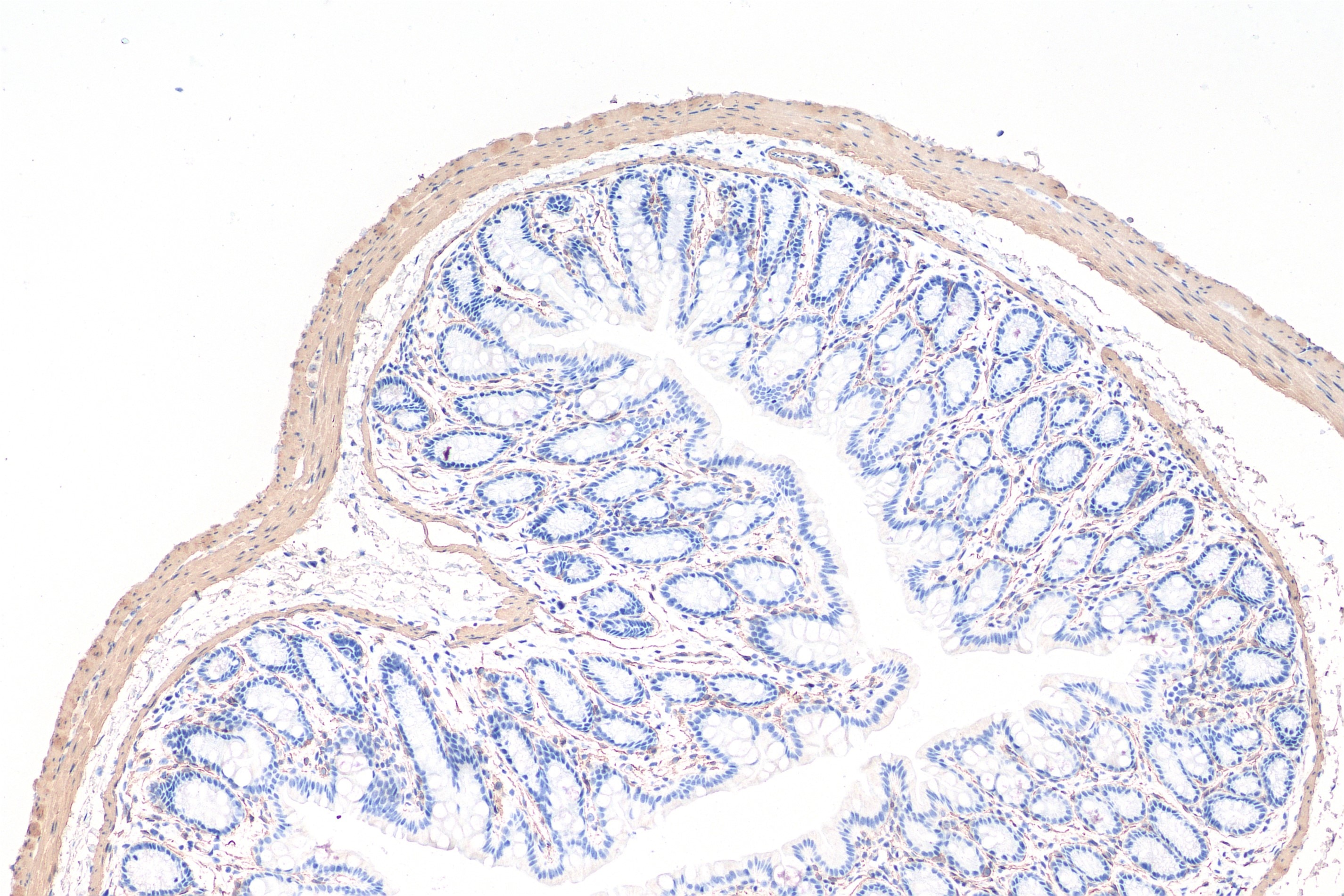 Immunohistochemical analysis of paraffin-embedded mouse colon tissue slide using 80008-1-RR (smooth muscle actin recombinant antibody) at dilution of 1:10000 (under 10x lens). Heat mediated antigen retrieval with Tris-EDTA buffer (pH 9.0). Multi-rAb Polymer HRP-Goat anti-rabbit Recombinant secondary antibody RGAR011 was used for detection.