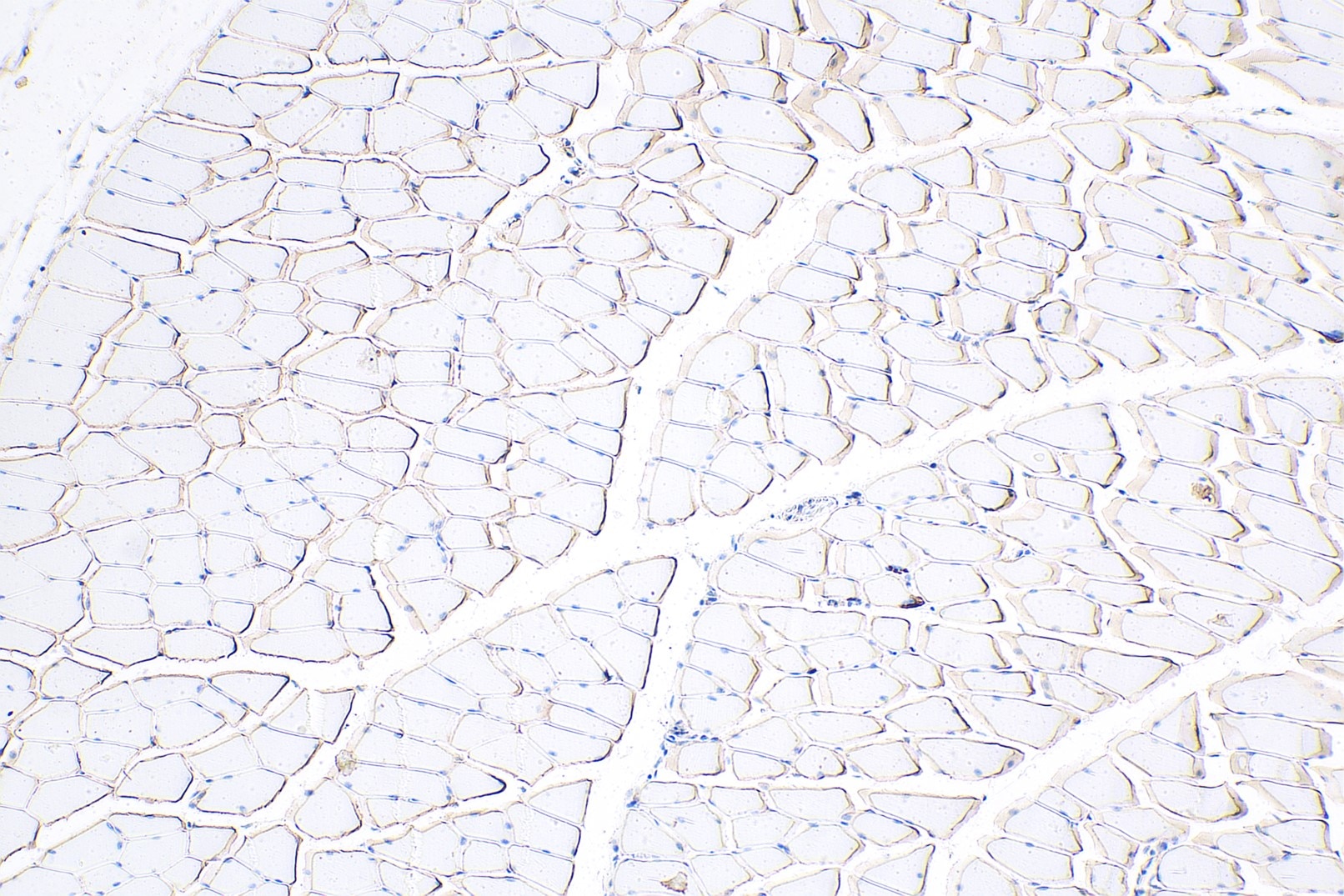 Immunohistochemical analysis of paraffin-embedded mouse skeletal muscle tissue slide using 12715-1-AP (Dystrophin polyclonal antibody) at dilution of 1:10000 (under 10x lens). Heat mediated antigen retrieval with Tris-EDTA buffer (pH 9.0). Multi-rAb Polymer HRP-Goat anti-rabbit Recombinant secondary antibody RGAR011 was used for detection.