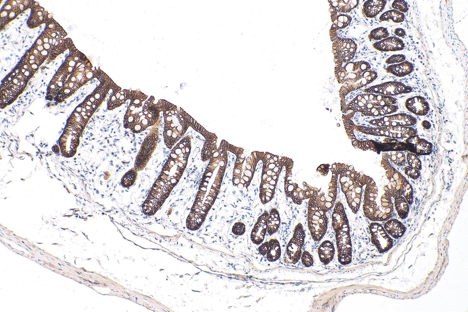 Immunohistochemical analysis of paraffin-embedded mouse colon tissue slide using E-cadherin polyclonal antibody. Multi-rAb Polymer HRP-Goat anti-rabbit Recombinant secondary antibody was used for detection