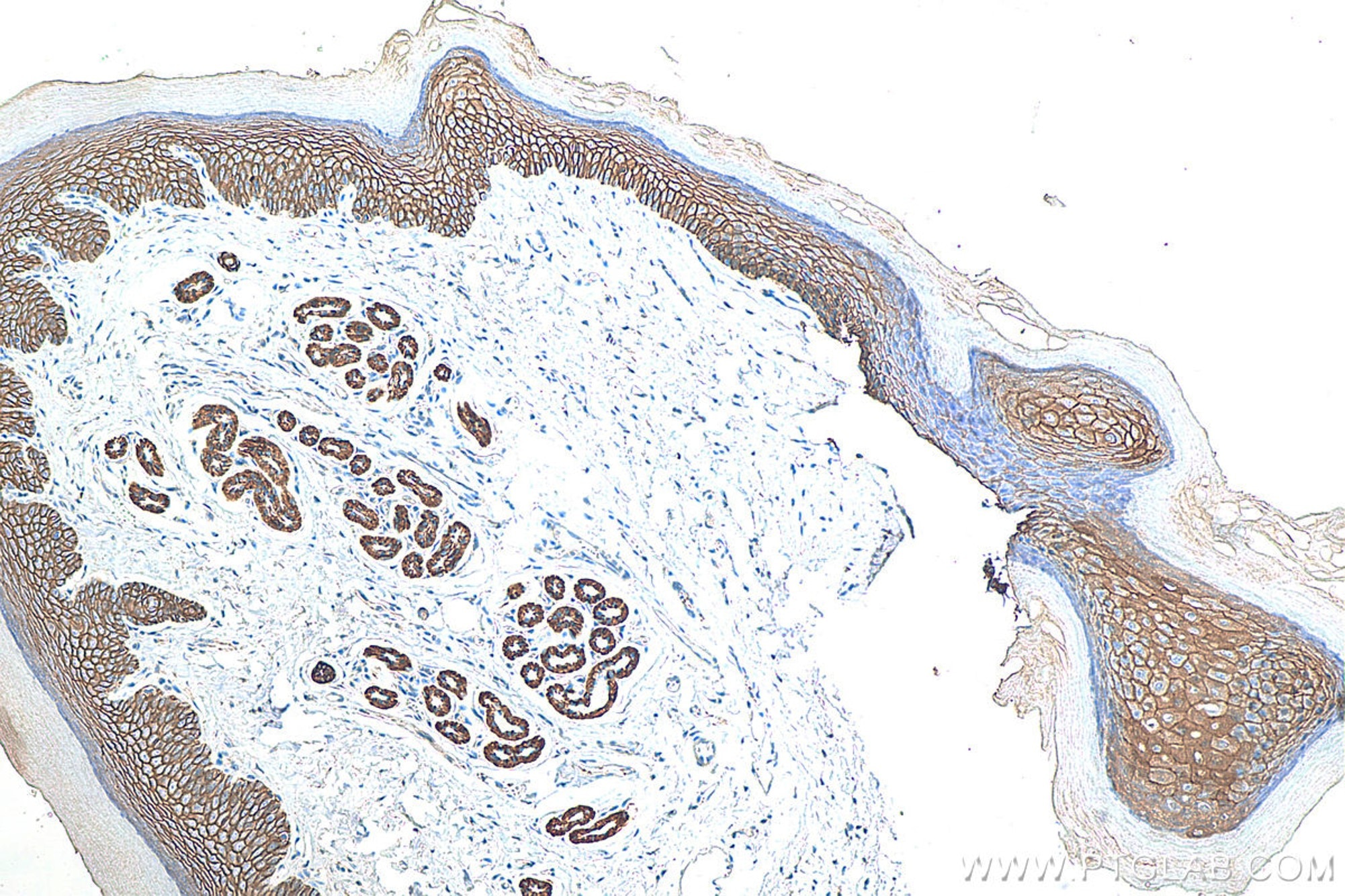 Immunohistochemical analysis of paraffin-embedded mouse skin tissue slide using 20874-1-AP (E-cadherin polyclonal antibody) at dilution of 1:5000 (under 10x lens). Heat mediated antigen retrieval with Tris-EDTA buffer (pH 9.0). Multi-rAb Polymer HRP-Goat anti-rabbit Recombinant secondary antibody RGAR011 was used for detection.