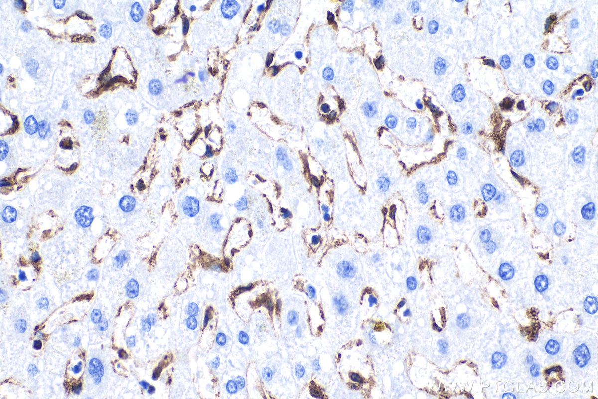 Immunohistochemical analysis of paraffin-embedded human liver tissue slide using 80165-1-RR (TMEM173/STING antibody) at dilution of 1:2000. Heat mediated antigen retrieval with Tris-EDTA buffer (pH 9.0). Multi-rAb Polymer HRP-Goat anti-rabbit Recombinant secondary antibody RGAR011 was used for detection.