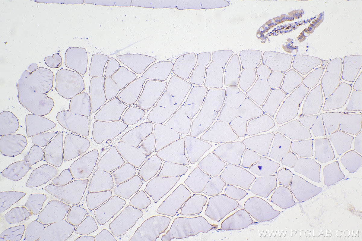 Immunohistochemical analysis of paraffin-embedded rat skeletal muscle tissue slide using 12715-1-AP (Dystrophin antibody) at dilution of 1:10000 (under 10x lens). Heat mediated antigen retrieval with Tris-EDTA buffer (pH 9.0). Multi-rAb Polymer HRP-Goat anti-rabbit Recombinant secondary antibody RGAR011 was used for detection. The staining was performed on Celnovte's CNT360-M1 autostainer. Multi-rAb Polymer HRP-Goat anti-rabbit Recombinant secondary antibody RGAR011 was used for detection. The staining was performed on Celnovte's CNT360-M1 autostainer.