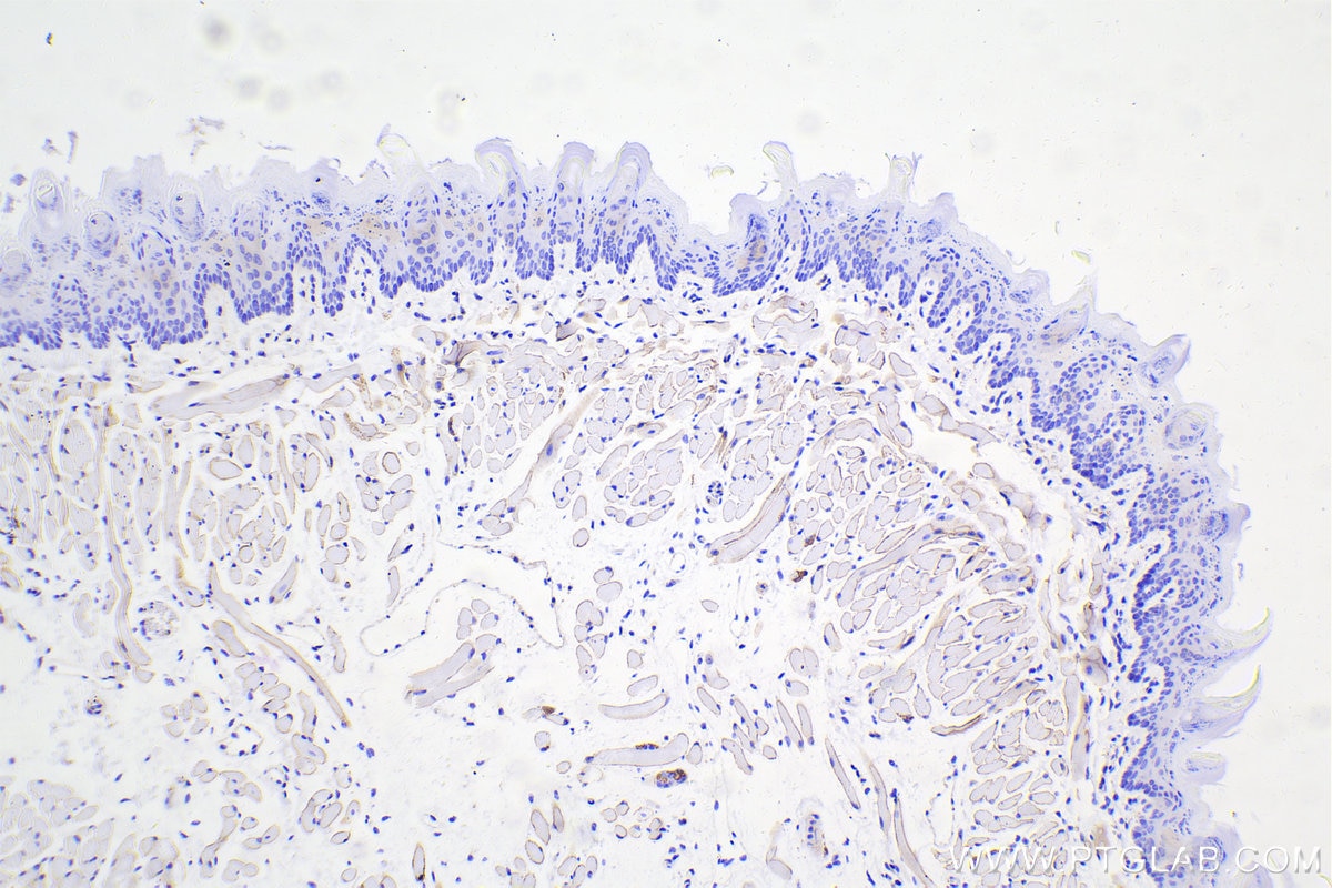 Immunohistochemical analysis of paraffin-embedded mouse tongue tissue slide using 12715-1-AP (Dystrophin antibody) at dilution of 1:10000 (under 10x lens). Heat mediated antigen retrieval with Tris-EDTA buffer (pH 9.0). Multi-rAb Polymer HRP-Goat anti-rabbit Recombinant secondary antibody RGAR011 was used for detection. The staining was performed on Celnovte's CNT360-M1 autostainer.