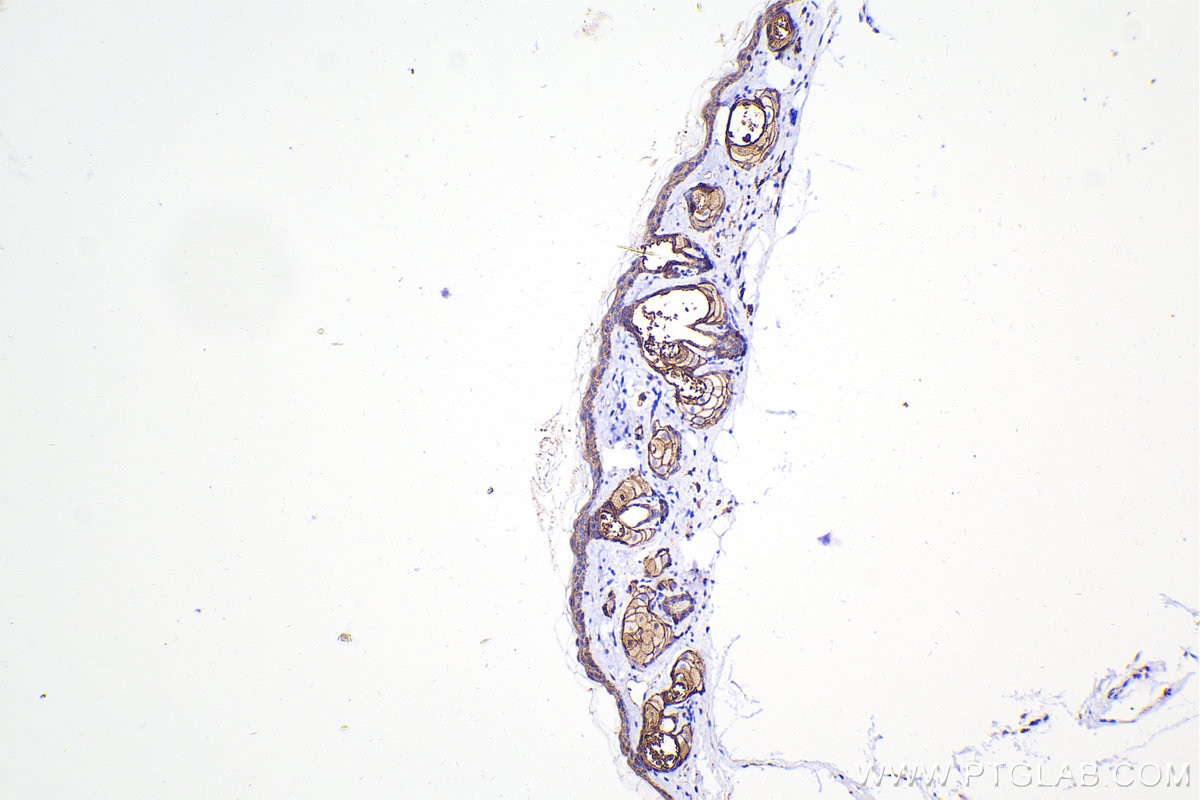 Immunohistochemical analysis of paraffin-embedded mouse skin tissue slide using 20874-1-AP (E-cadherin antibody) at dilution of 1:5000 (under 10x lens). Heat mediated antigen retrieval with Tris-EDTA buffer (pH 9.0). Multi-rAb™ Polymer HRP-Goat anti-rabbit Recombinant secondary antibody RGAR011 was used for detection. The staining was performed on Celnovte's CNT360-M1 autostainer.