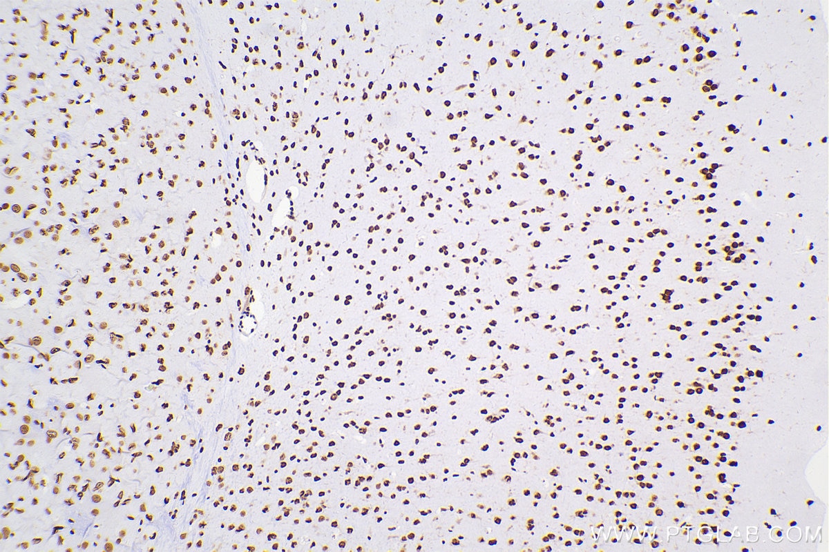 Immunohistochemical analysis of paraffin-embedded mouse brain tissue slide using 80001-1-RR (TDP-43 antibody) at dilution of 1:4000 (under 10x lens). Heat mediated antigen retrieval with Tris-EDTA buffer (pH 9.0). Multi-rAb Polymer HRP-Goat anti-rabbit Recombinant secondary antibody RGAR011 was used for detection. The staining was performed on Celnovte's CNT360-M1 autostainer.