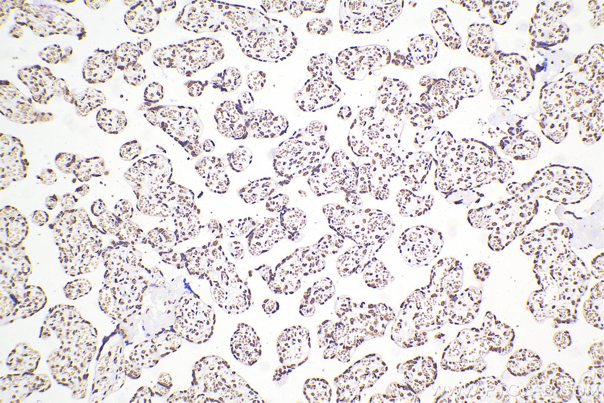 Immunohistochemical analysis of paraffin-embedded human placenta tissue slide using 80001-1-RR (TDP-43 antibody) at dilution of 1:4000 (under 10x lens). Heat mediated antigen retrieval with Tris-EDTA buffer (pH 9.0). Multi-rAb Polymer HRP-Goat anti-rabbit Recombinant secondary antibody RGAR011 was used for detection. The staining was performed on Celnovte's CNT360-M1 autostainer.