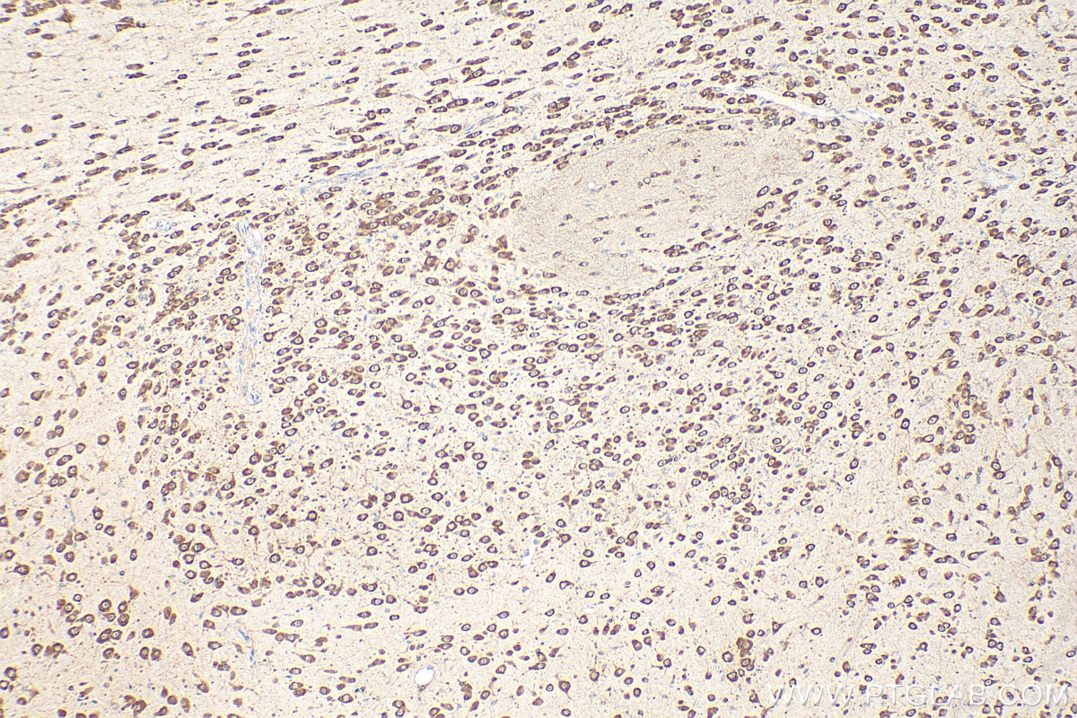 Immunohistochemical analysis of paraffin-embedded mouse brain tissue slide using 10095-2-AP (EEF1B2 antibody) and Biotin-conjugated Donkey Anti-Rabbit IgG(H+L) (SA00004-11) at dilution of 1:200.