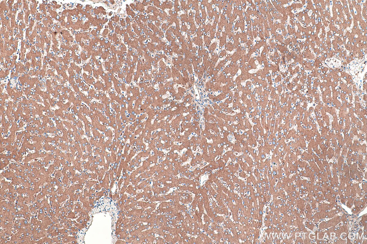 Immunohistochemical analysis of paraffin-embedded human liver tissue slide using KHC0378 (A2M IHC Kit).