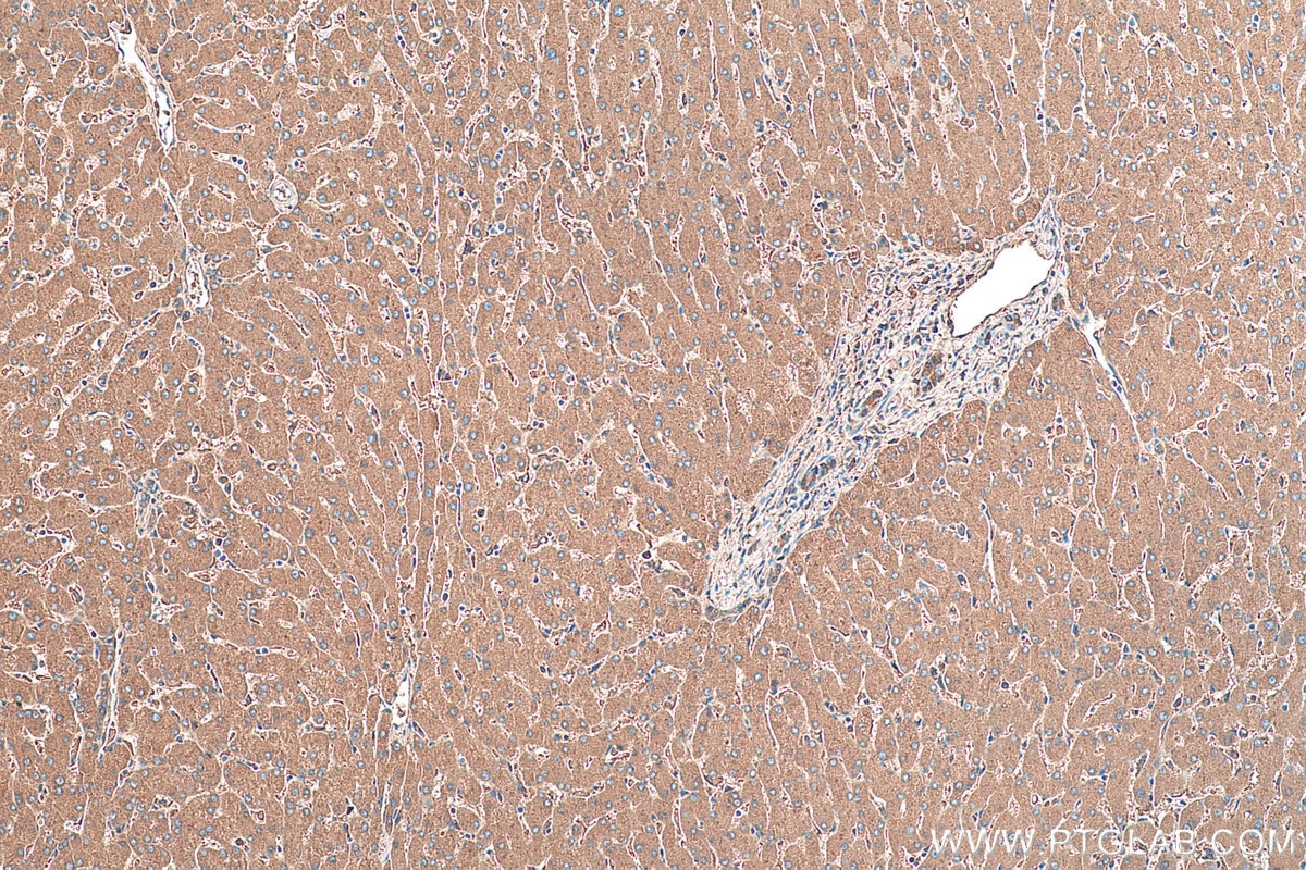 Immunohistochemical analysis of paraffin-embedded human liver tissue slide using KHC0379 (SERPINA1/AAT IHC Kit).