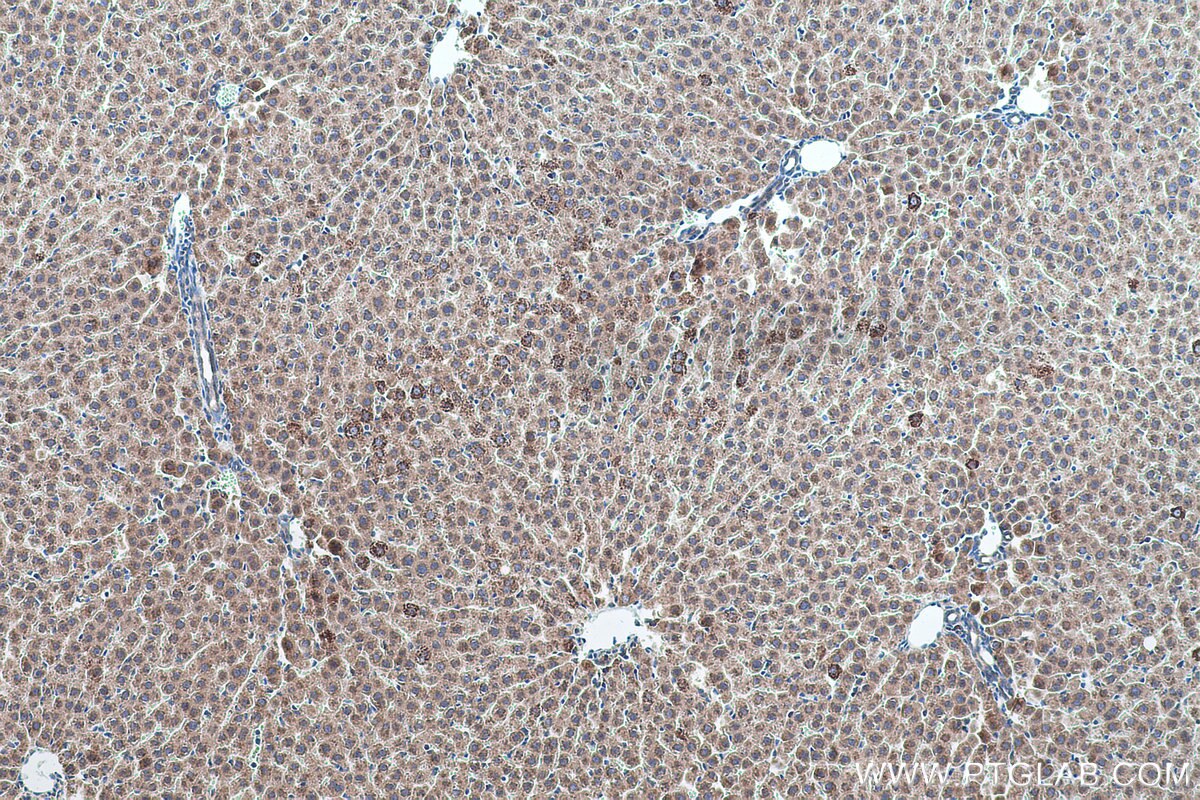 Immunohistochemical analysis of paraffin-embedded rat liver tissue slide using KHC0547 (ABAT IHC Kit).