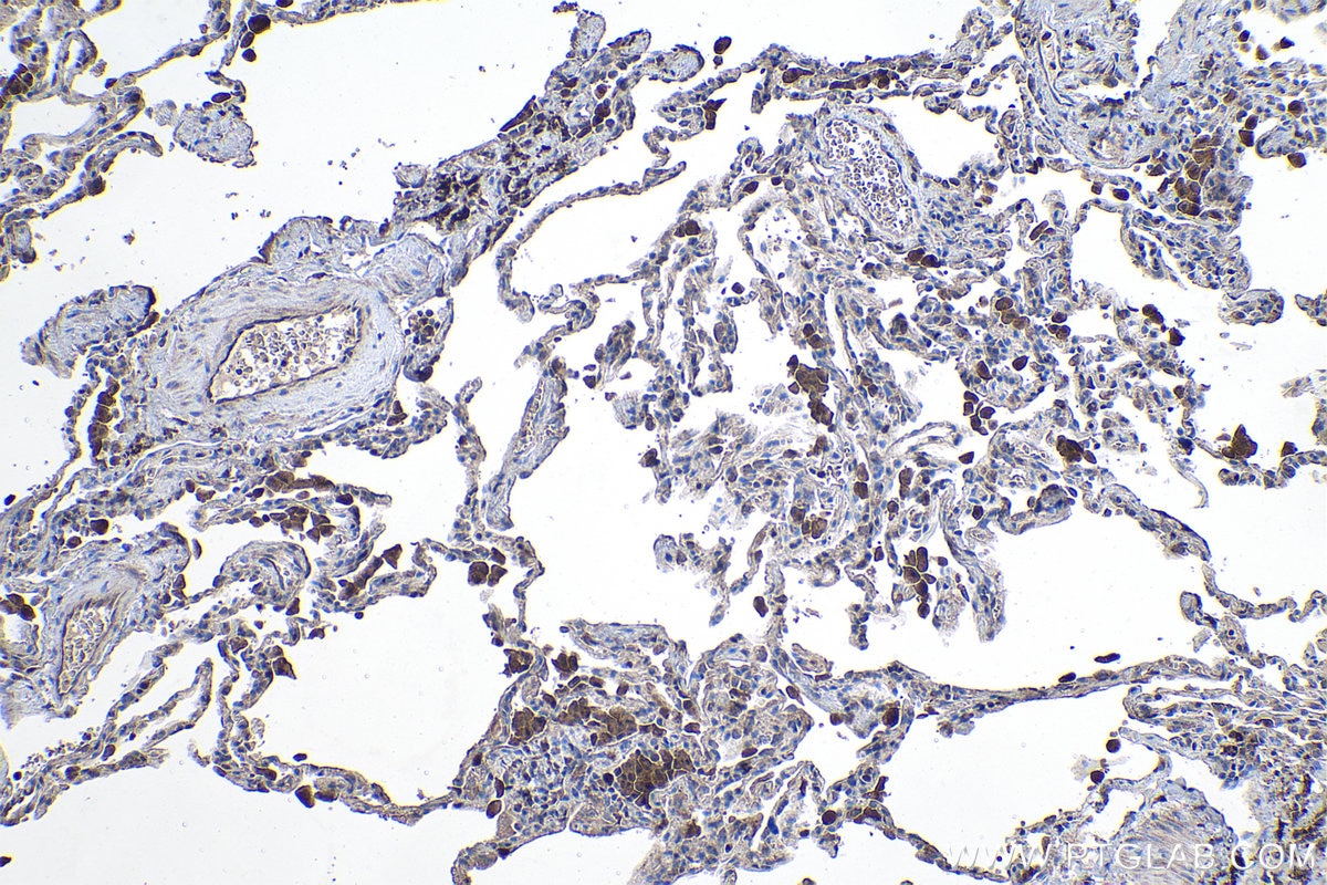 Immunohistochemical analysis of paraffin-embedded human lung tissue slide using KHC1096 (ABCA3 IHC Kit).