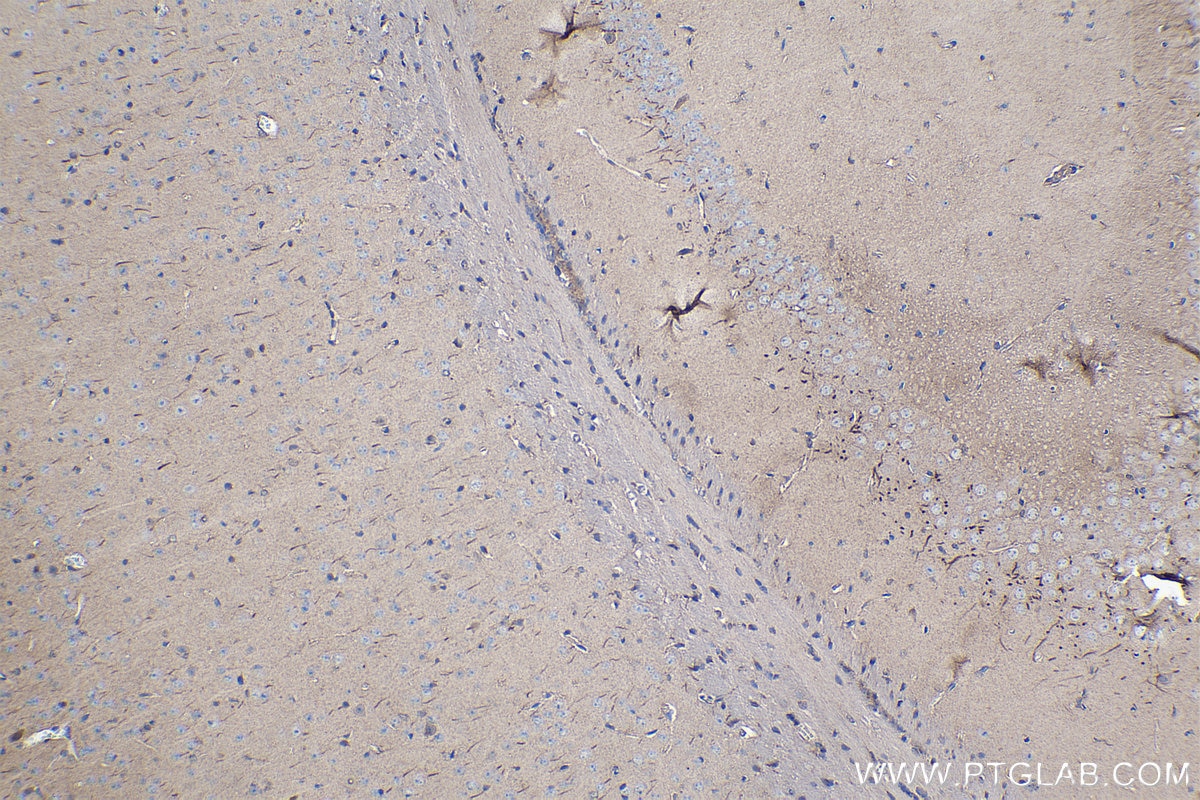 Immunohistochemical analysis of paraffin-embedded mouse brain tissue slide using KHC1096 (ABCA3 IHC Kit).