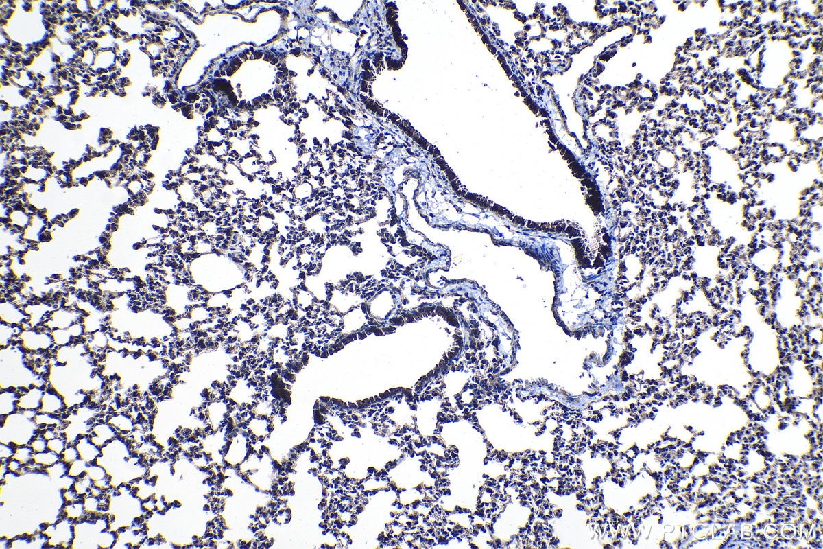 Immunohistochemical analysis of paraffin-embedded mouse lung tissue slide using KHC1096 (ABCA3 IHC Kit).