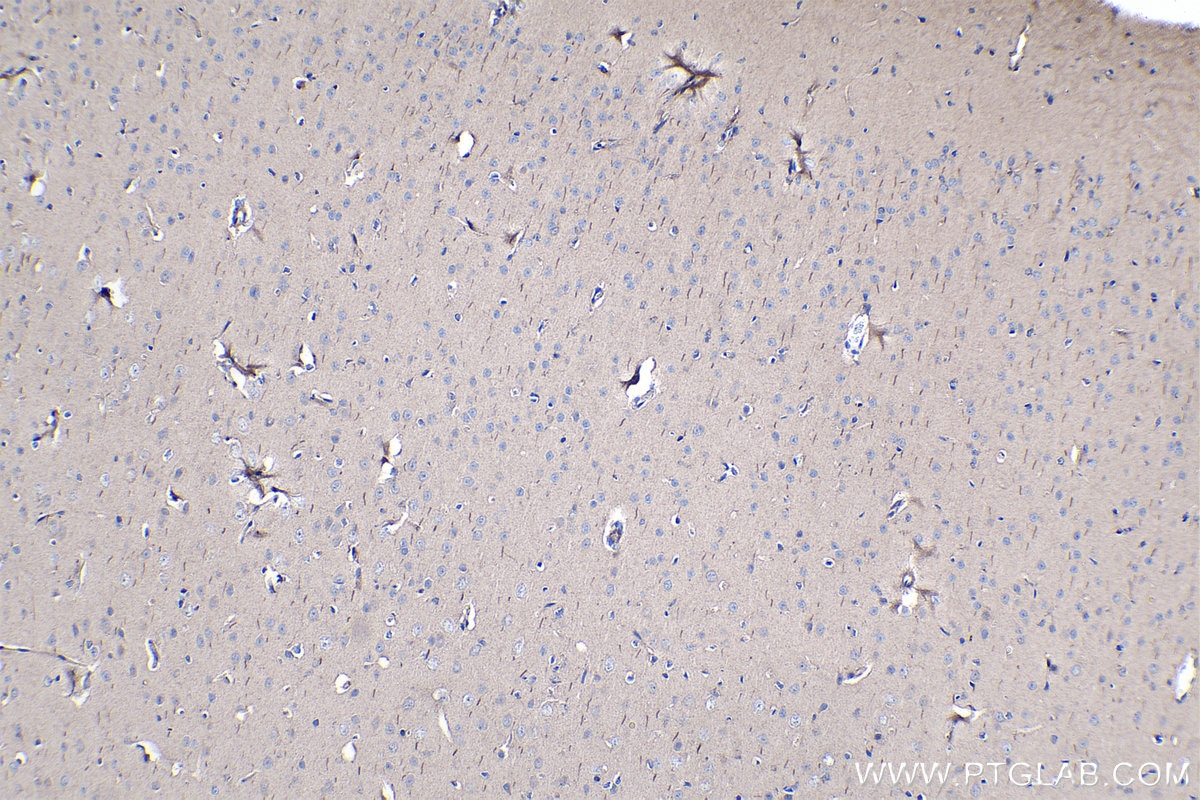 Immunohistochemical analysis of paraffin-embedded rat brain tissue slide using KHC1096 (ABCA3 IHC Kit).