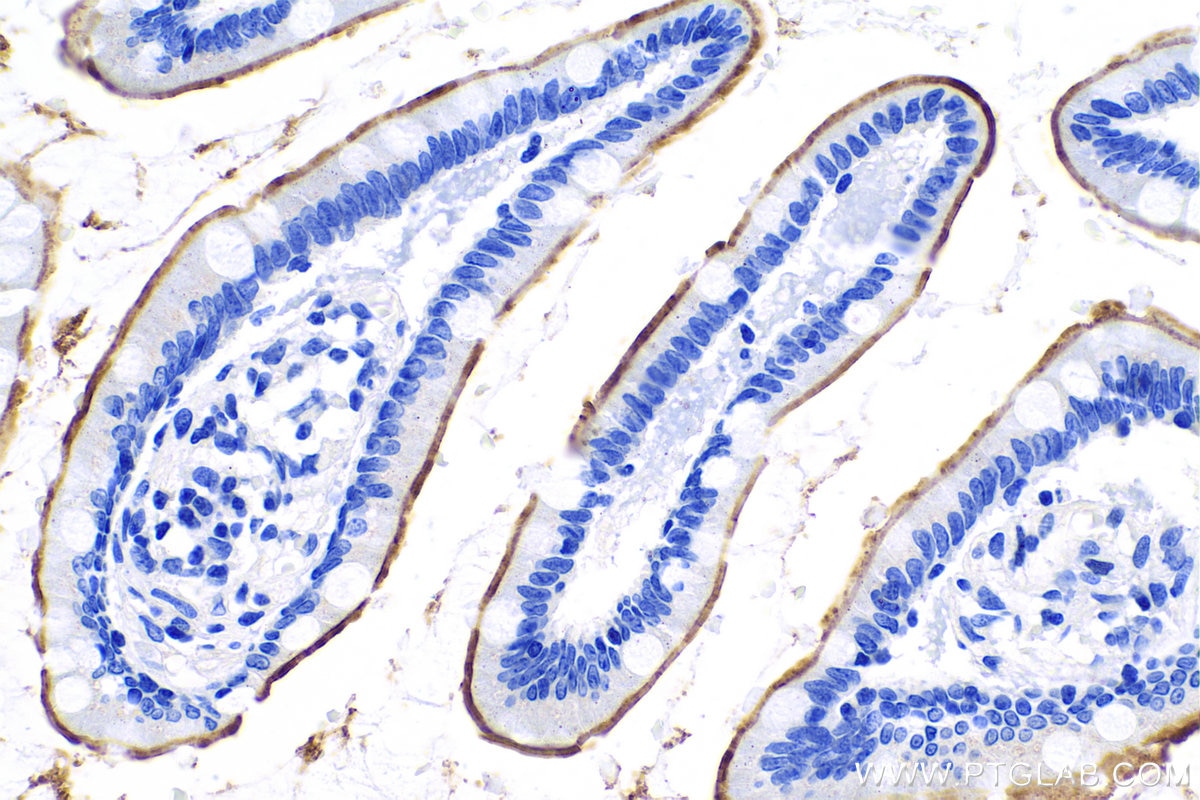 Immunohistochemical analysis of paraffin-embedded human small intestine tissue slide using KHC0820 (P glycoprotein IHC Kit).