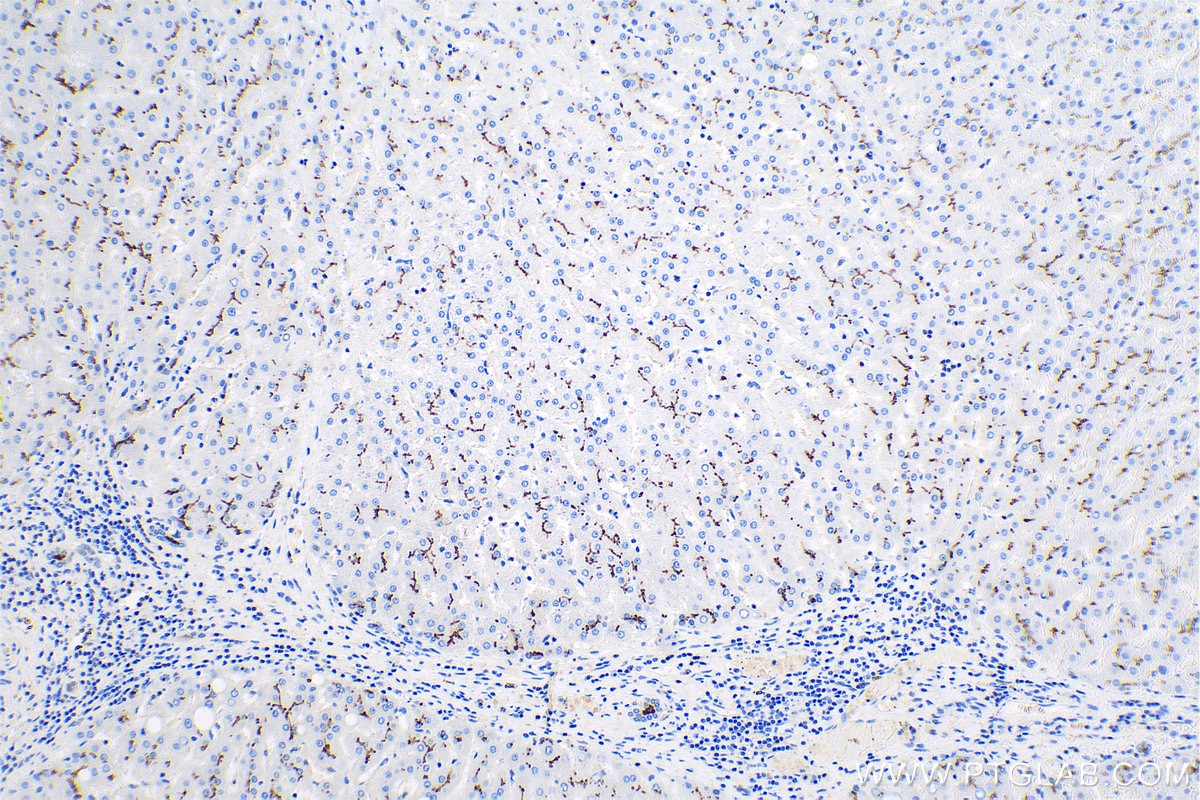 Immunohistochemical analysis of paraffin-embedded human liver tissue slide using KHC0820 (P glycoprotein IHC Kit).