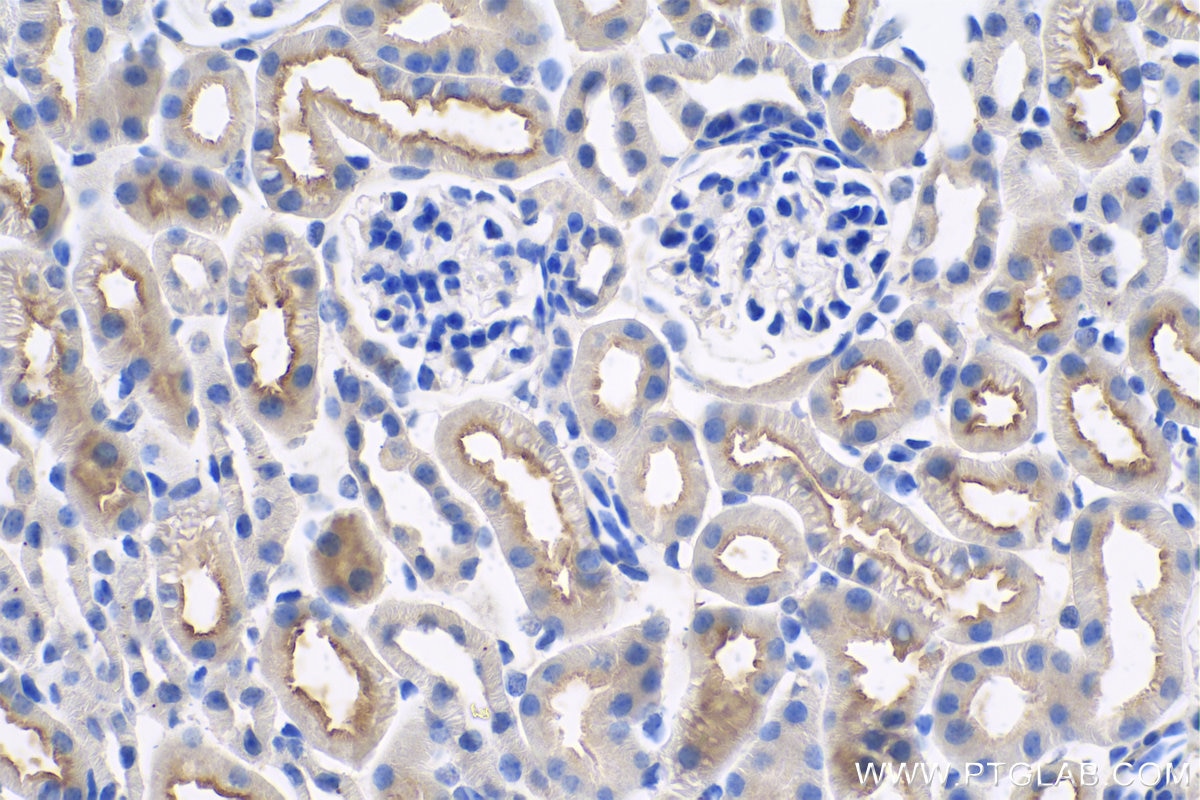 Immunohistochemical analysis of paraffin-embedded mouse kidney tissue slide using KHC0820 (P glycoprotein IHC Kit).