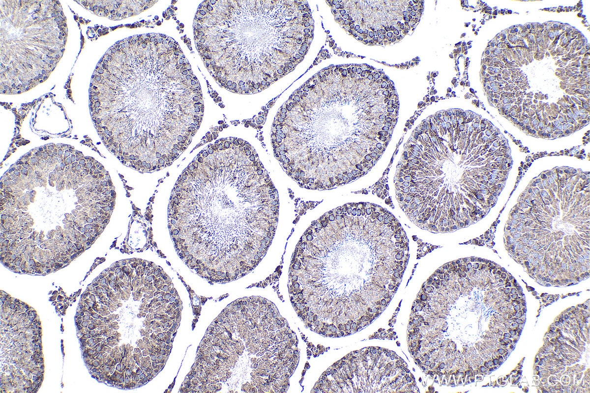 Immunohistochemical analysis of paraffin-embedded rat testis tissue slide using KHC1348 (ABCB9 IHC Kit).