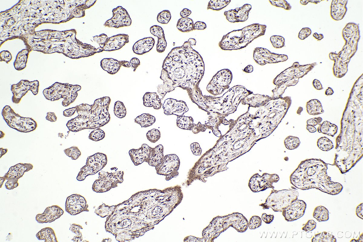 Immunohistochemical analysis of paraffin-embedded human placenta tissue slide using KHC2216 (ABCD3 IHC Kit).