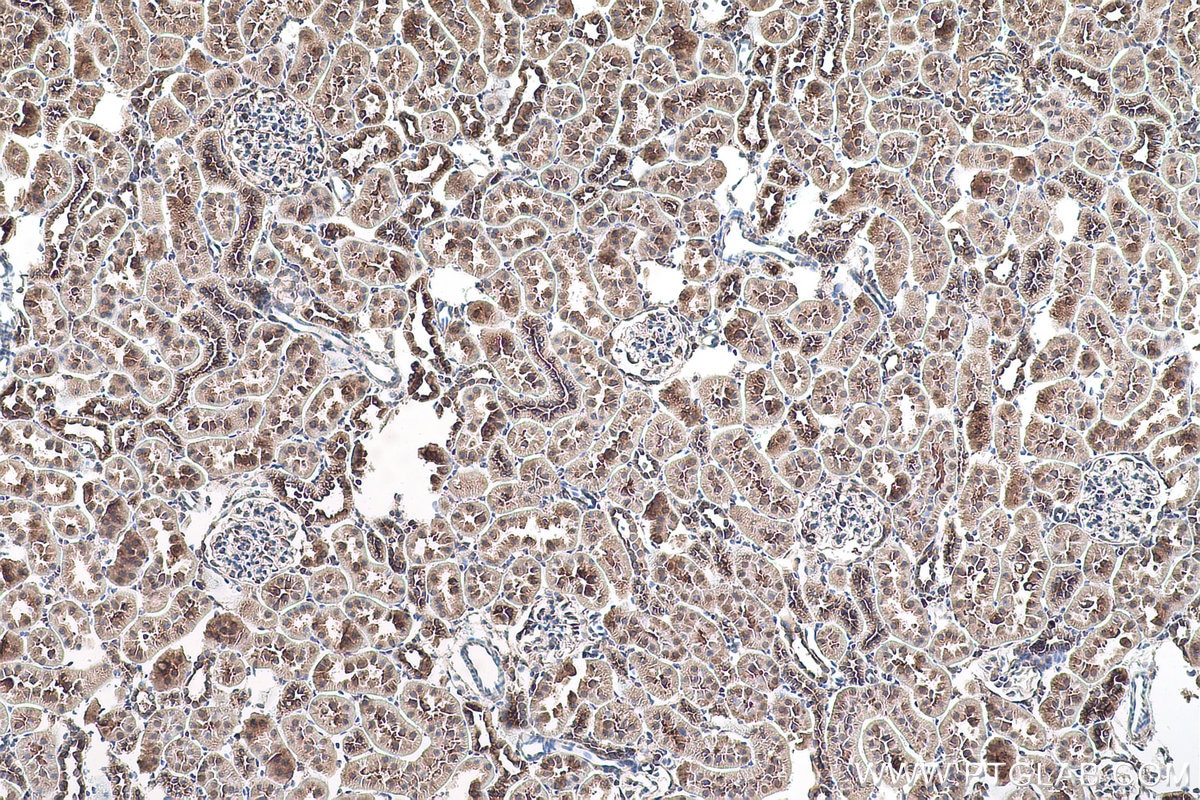 Immunohistochemical analysis of paraffin-embedded rat kidney tissue slide using KHC0909 (ABCE1 IHC Kit).