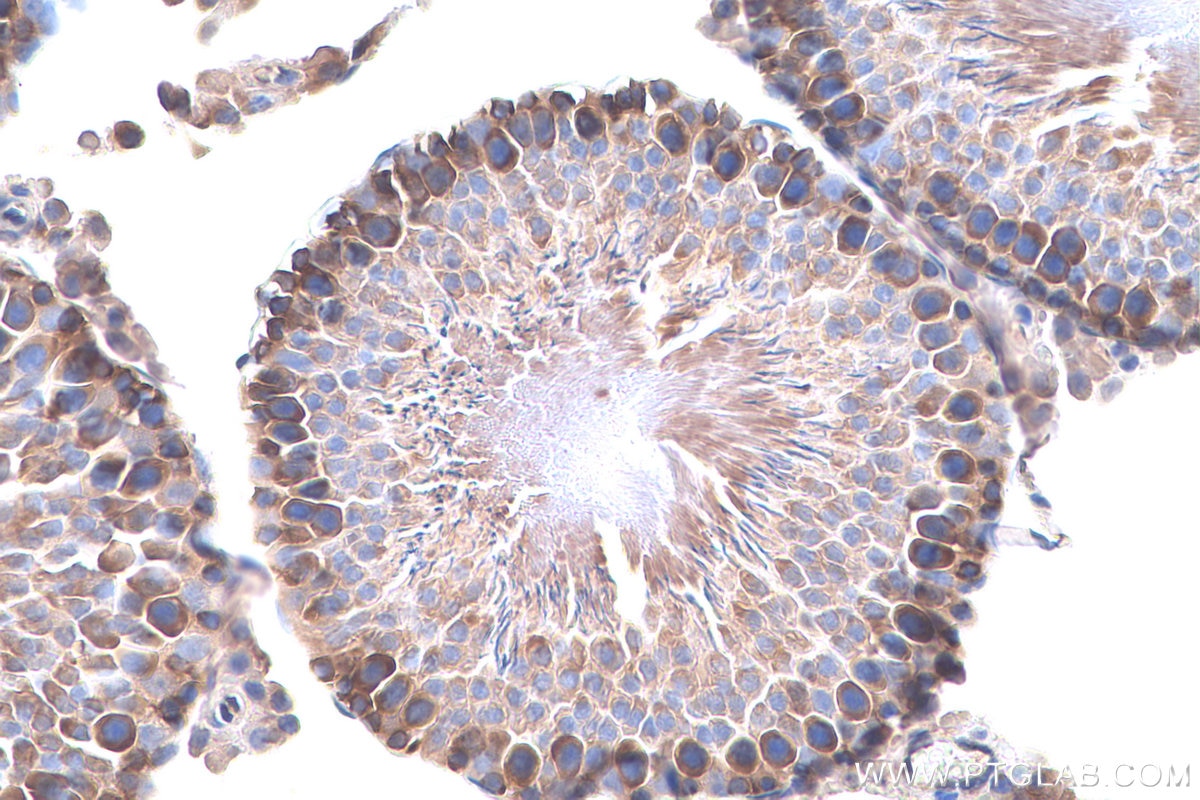 Immunohistochemical analysis of paraffin-embedded rat testis tissue slide using KHC0909 (ABCE1 IHC Kit).