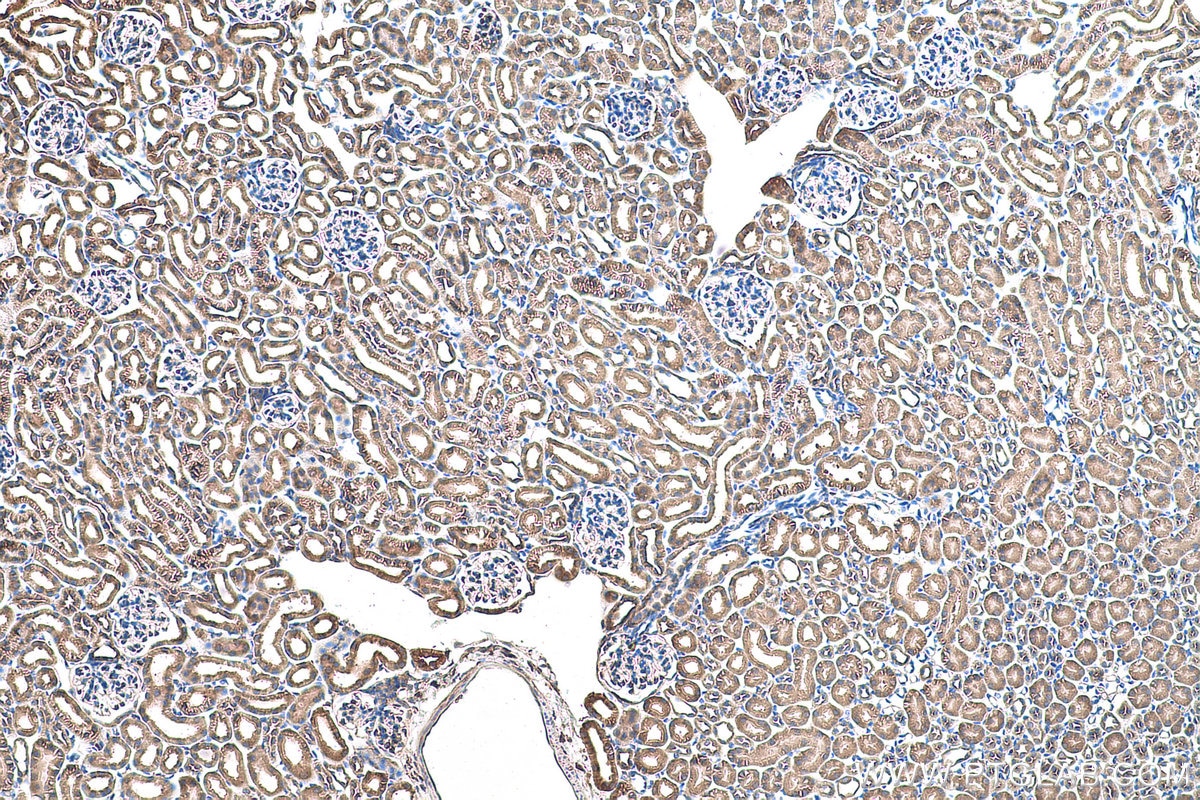 Immunohistochemical analysis of paraffin-embedded mouse kidney tissue slide using KHC0909 (ABCE1 IHC Kit).