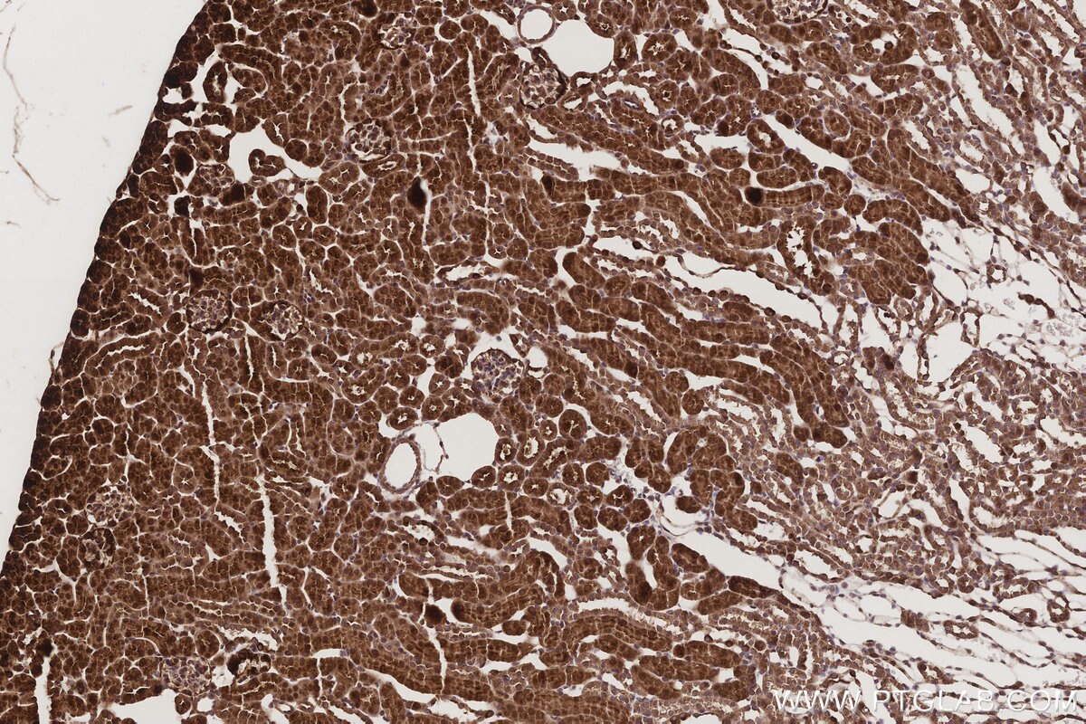 Immunohistochemical analysis of paraffin-embedded mouse kidney tissue slide using KHC3211 (ABCG1 IHC Kit).